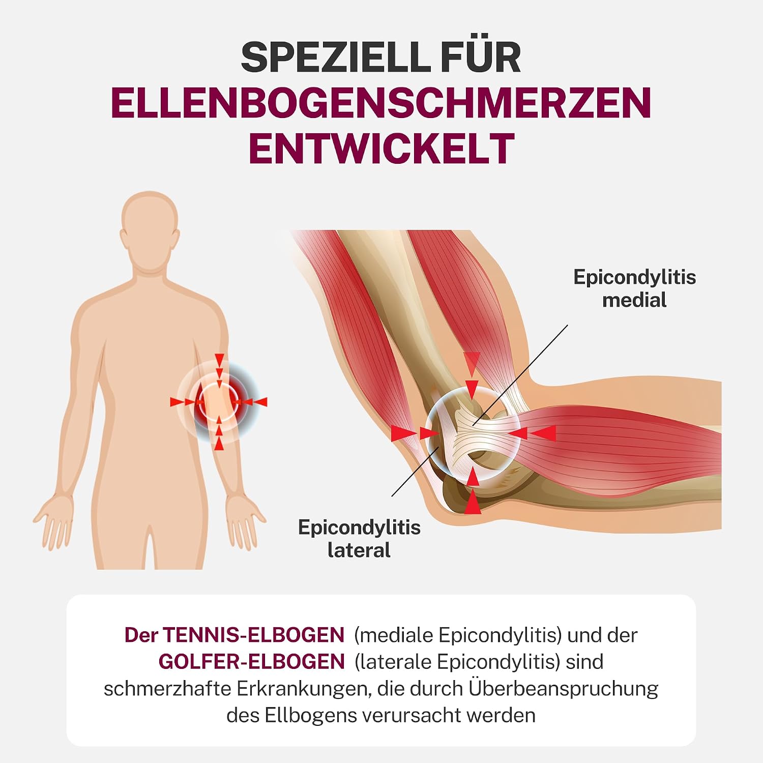 Detalle de Fitomo Epicondylitis Ellenbogenbandage L