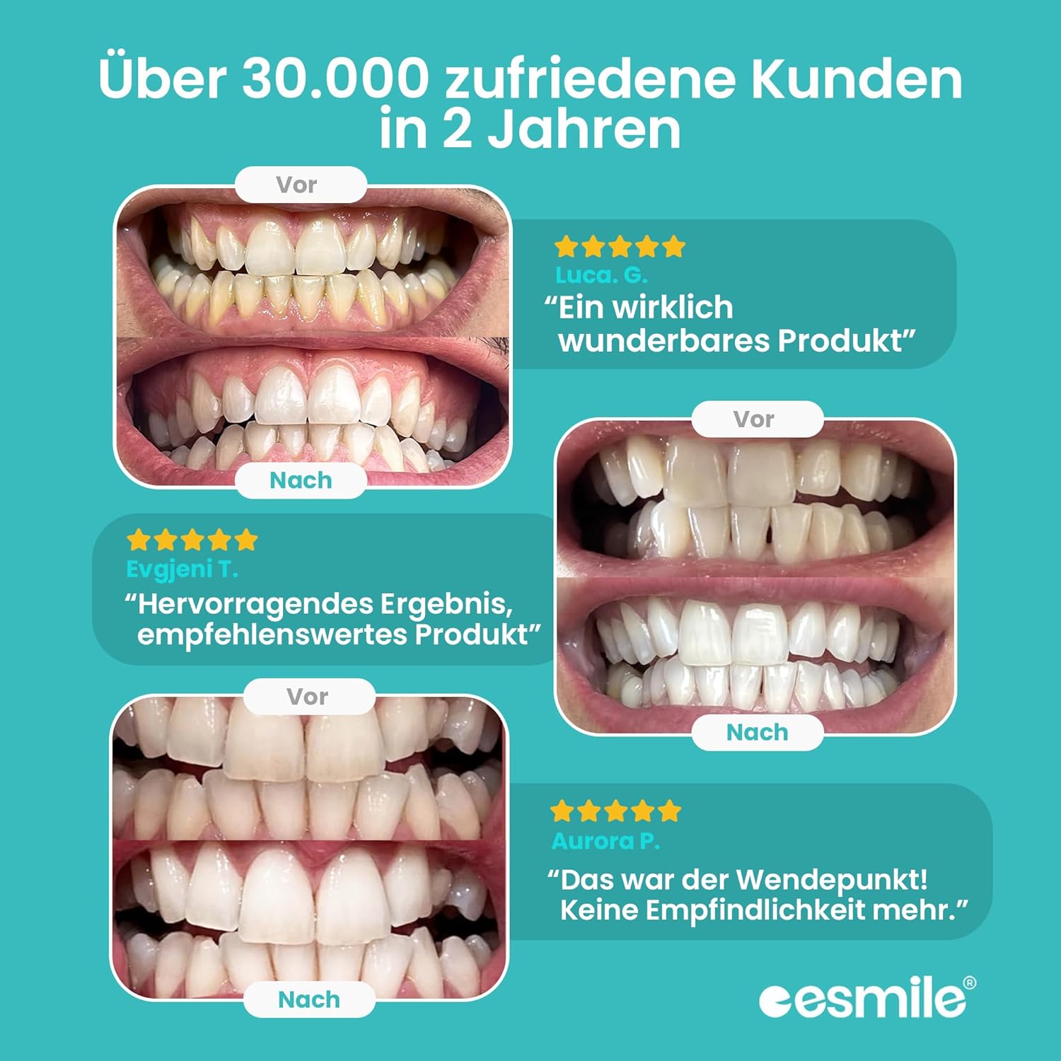 Detalle de EASY SMILE: Professionelles Zahnaufhellungs-Kit mit 16X LED-Licht – 3 Bleaching-Gele für Zu-Hause