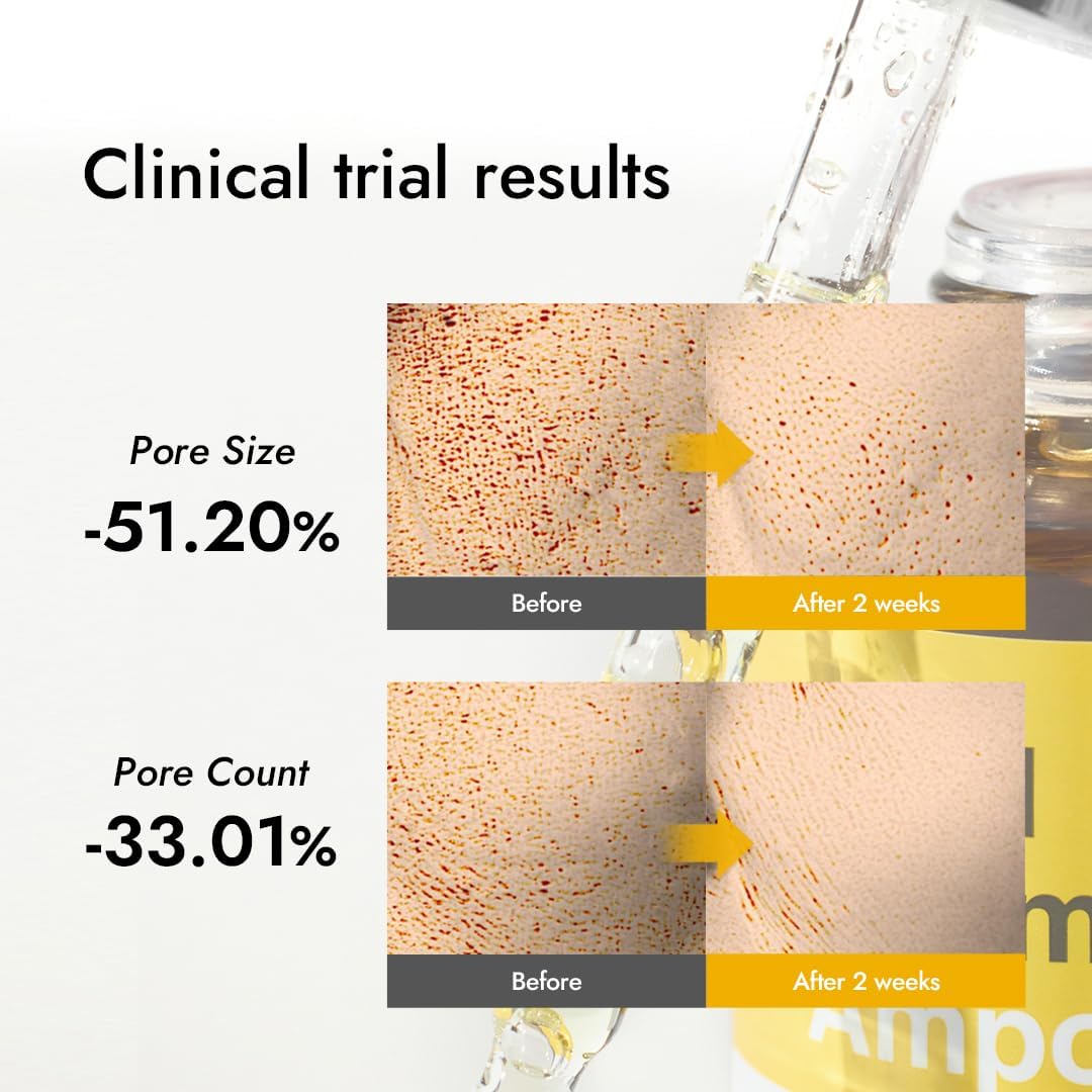 Thumbnail 6 de Mizon Real Vitamin C Ampoule 🍊