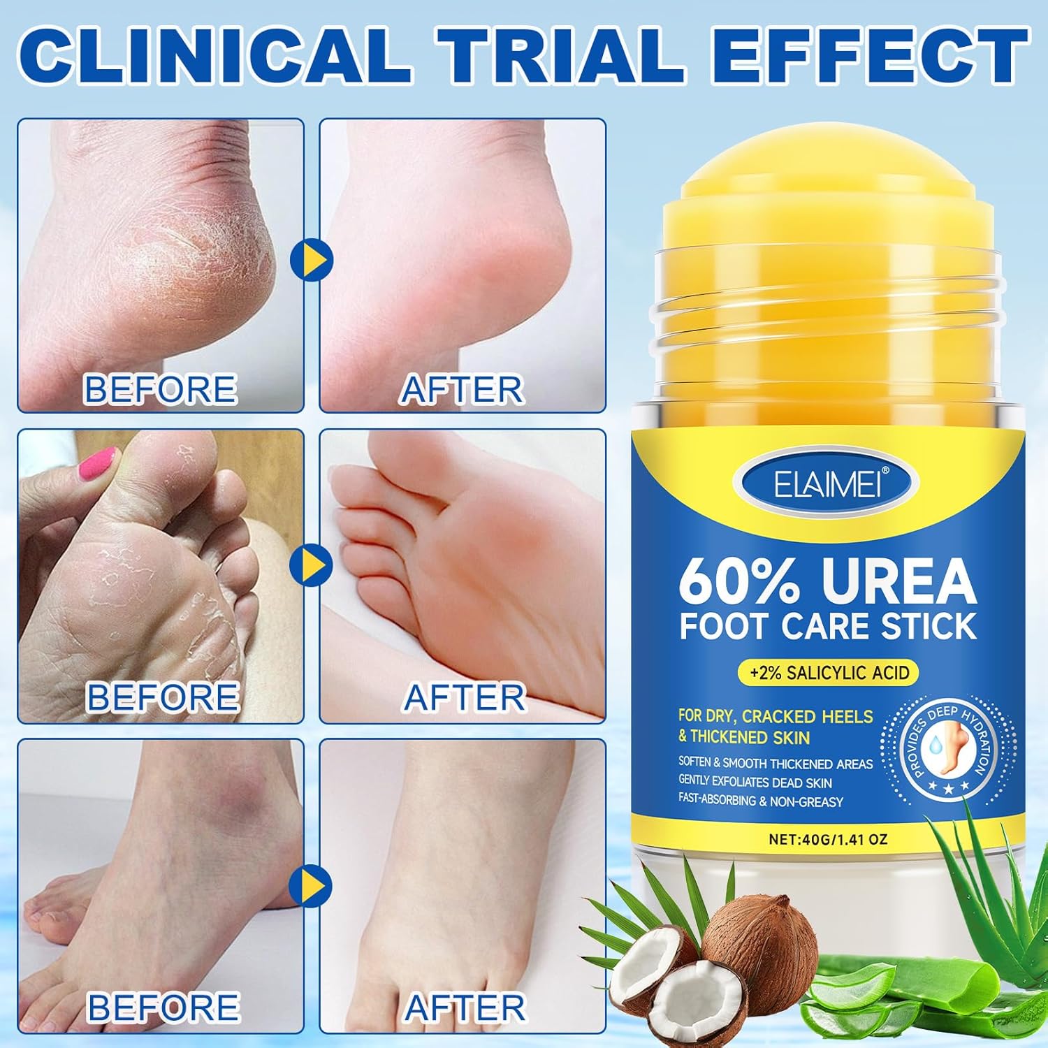 Thumbnail 6 de Urea Cream 60 % für Füße (60 % Harnstoff) Stick mit 2 % Salicylsäure, 40 g – für rissige Fersen