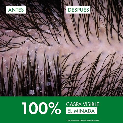 Thumbnail 4 de Vichy Dercos Technique Champú anticaspa para cabello graso, 200 ml