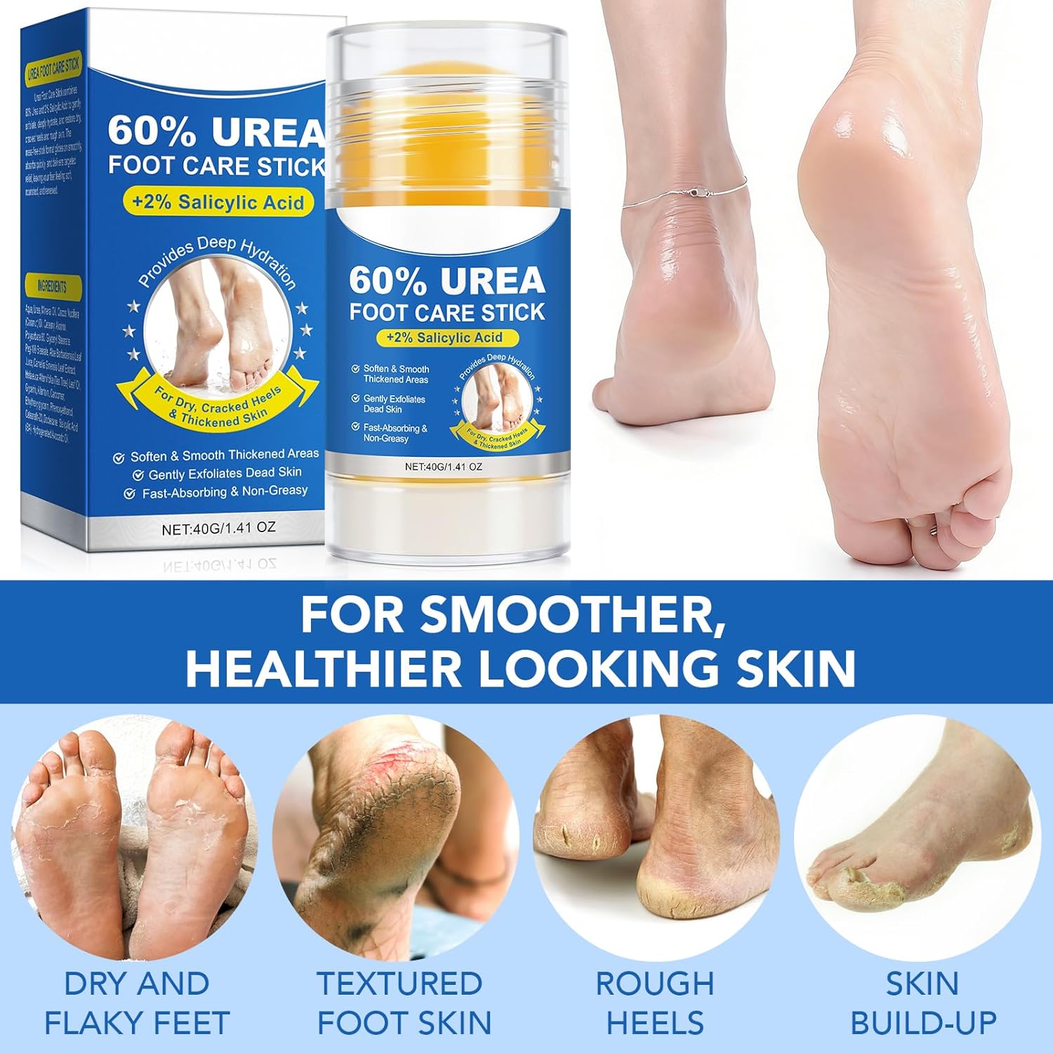 Thumbnail 2 de Crema piedi urea 60% + acido salicílico 2% – 40 g (2 pezzi): cura profonda per talloni screpolati