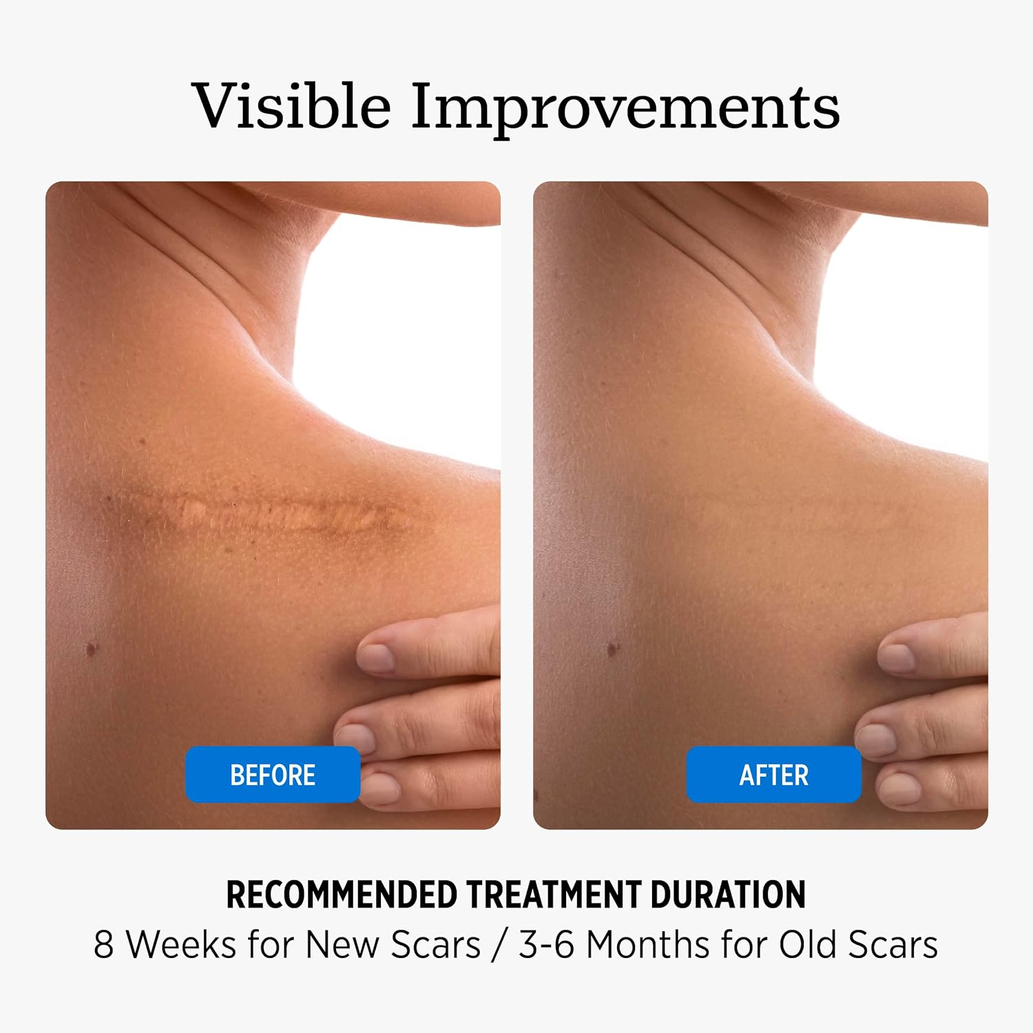 Detalle de NUVADERMIS Scar Gel: Advanced Scar Cream for Surgical and Acne Scars