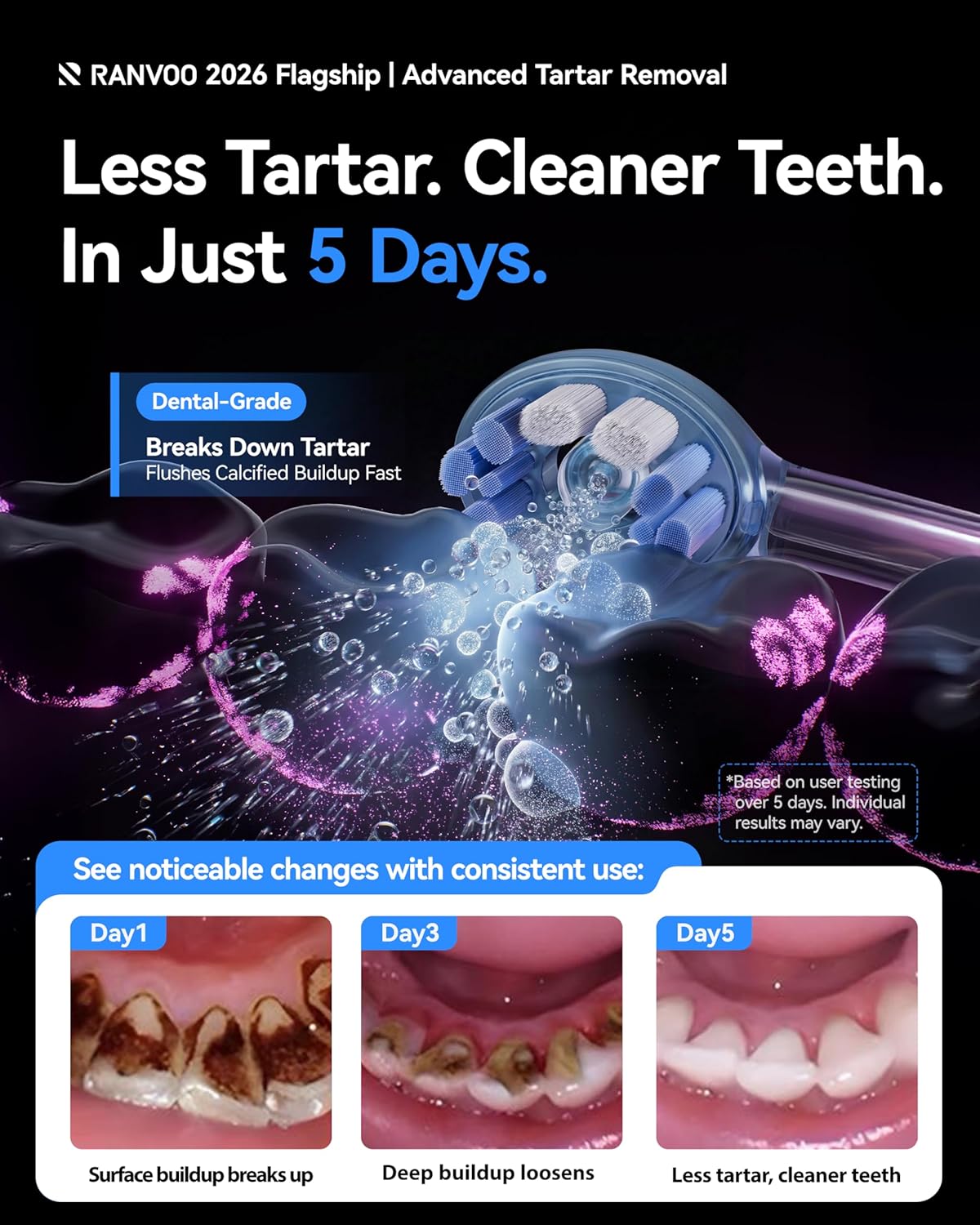 Detalle 2 de RANVOO AirJet X5 Sonic Electric Toothbrush (AirJet Jet-Flow, 60-Day Battery, 3 Pro Brush Heads) in Space Gray