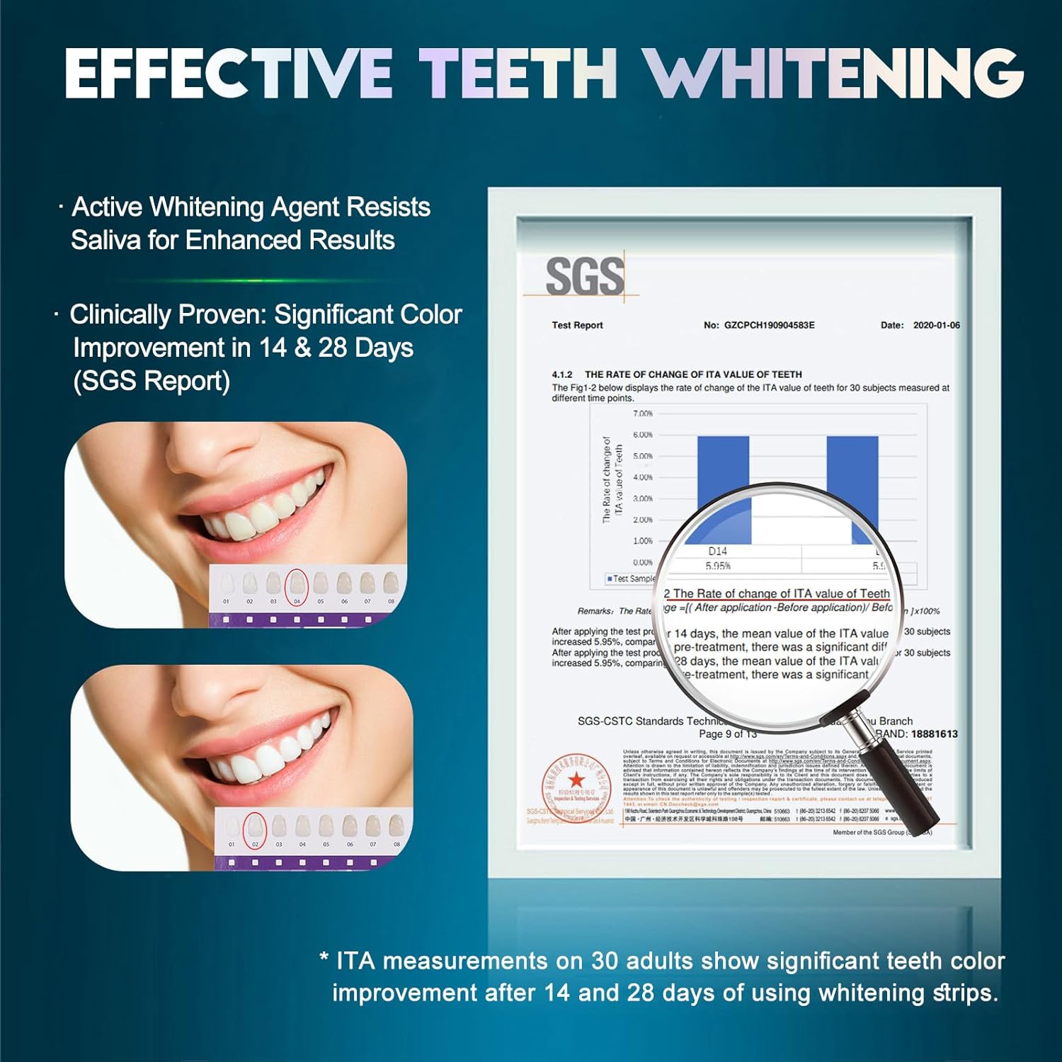 Detalle de Luiable Teeth Whitening Strips – Enamel-Safe, 14 Treatments (28 Strips) for a Brighter Smile