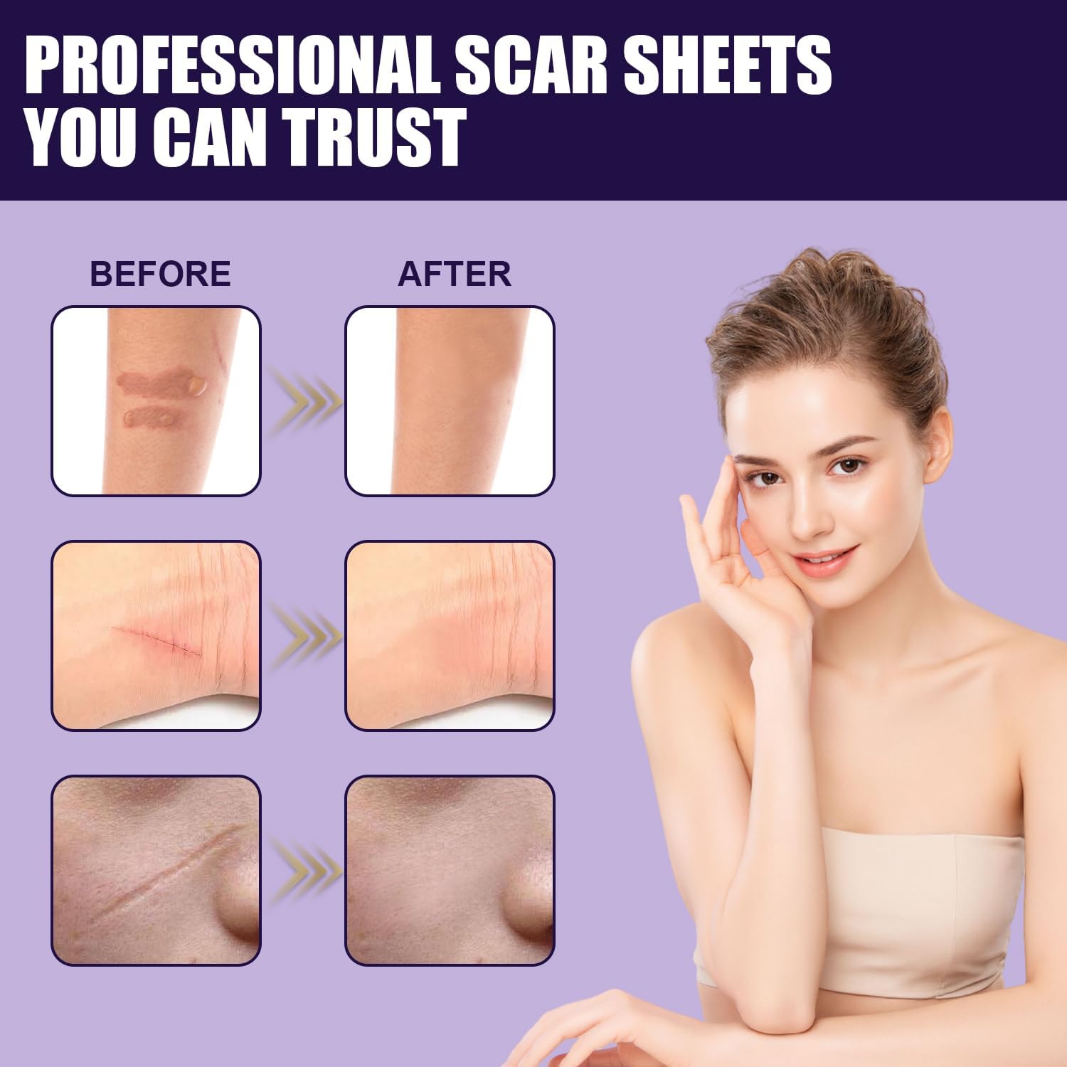 Thumbnail 2 de Silicone Scar Tape 4cm x 1.5M — Ultra‑Thin, Reusable Silicone Scar Sheets for Keloids, C‑Sections, Acne and More