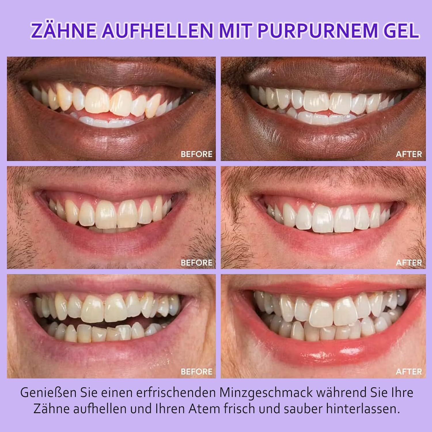 Thumbnail 4 de Zahnaufhellung Stift Purple Teeth Whitening Pen
