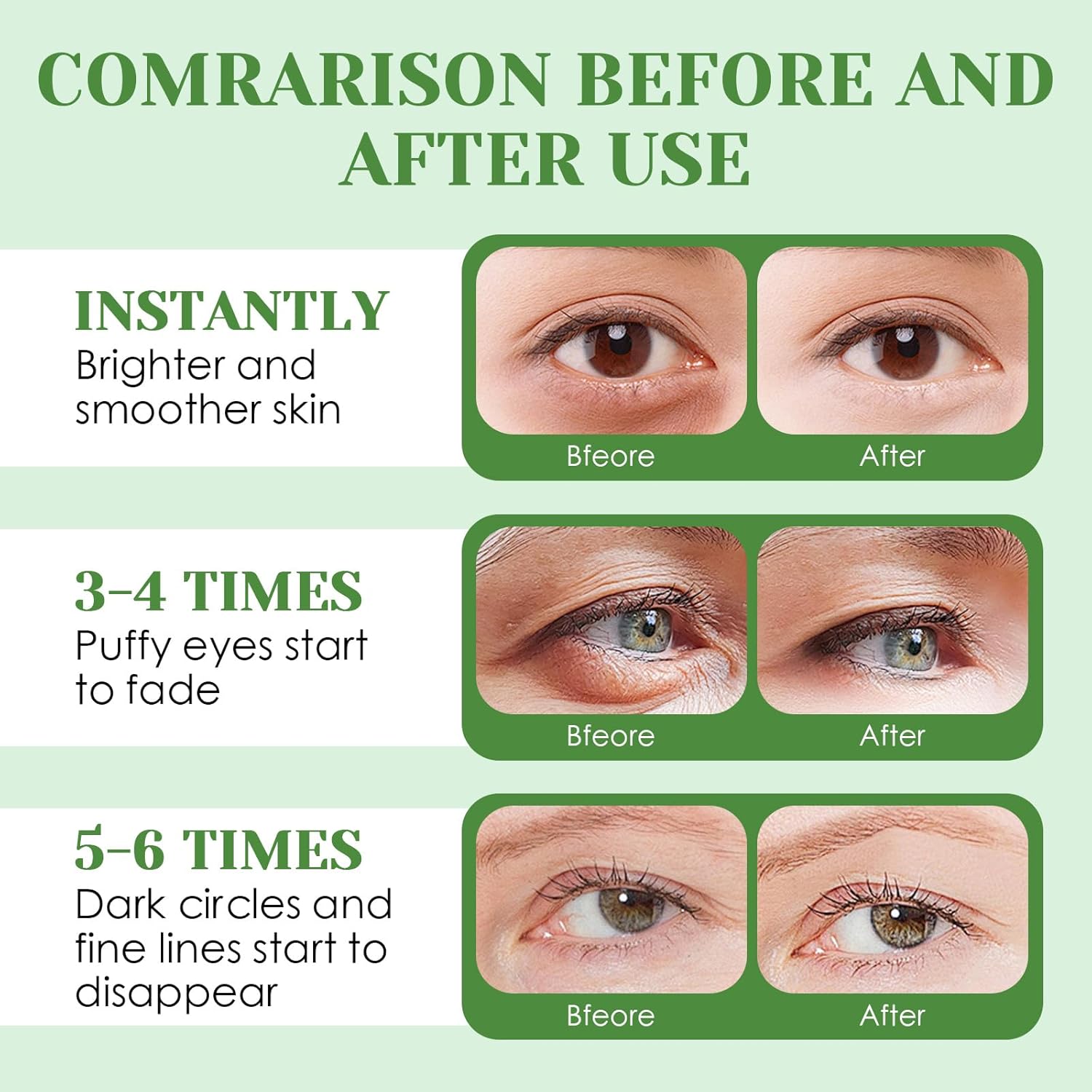 Detalle de Lot de 60 coussinets contour des yeux à l’aloe vera – Masque hydrogel hydratant 80 g
