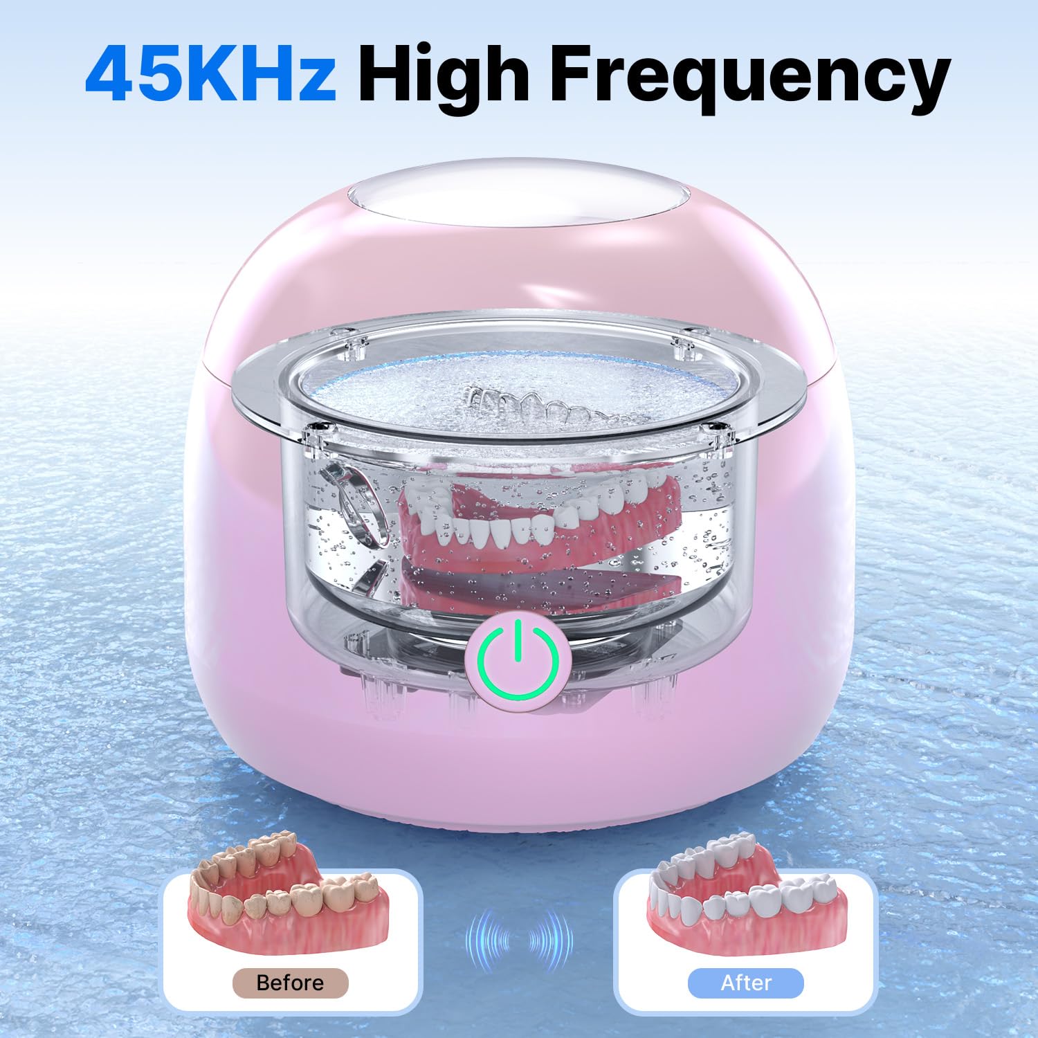 Detalle de CXRUY Ultrasonic Retainer Cleaner for Dentures, Braces, Aligners 🪥