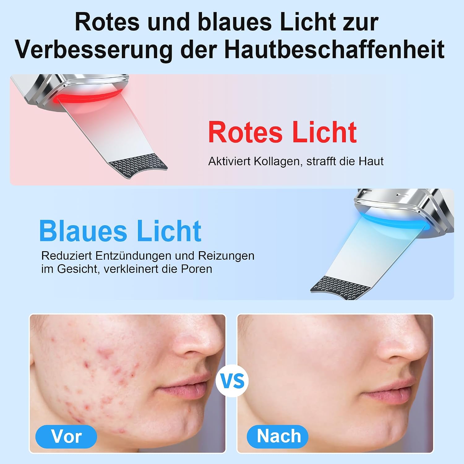 Detalle 2 de Yeerain Skin Scrubber Ultraschall Porenreiniger