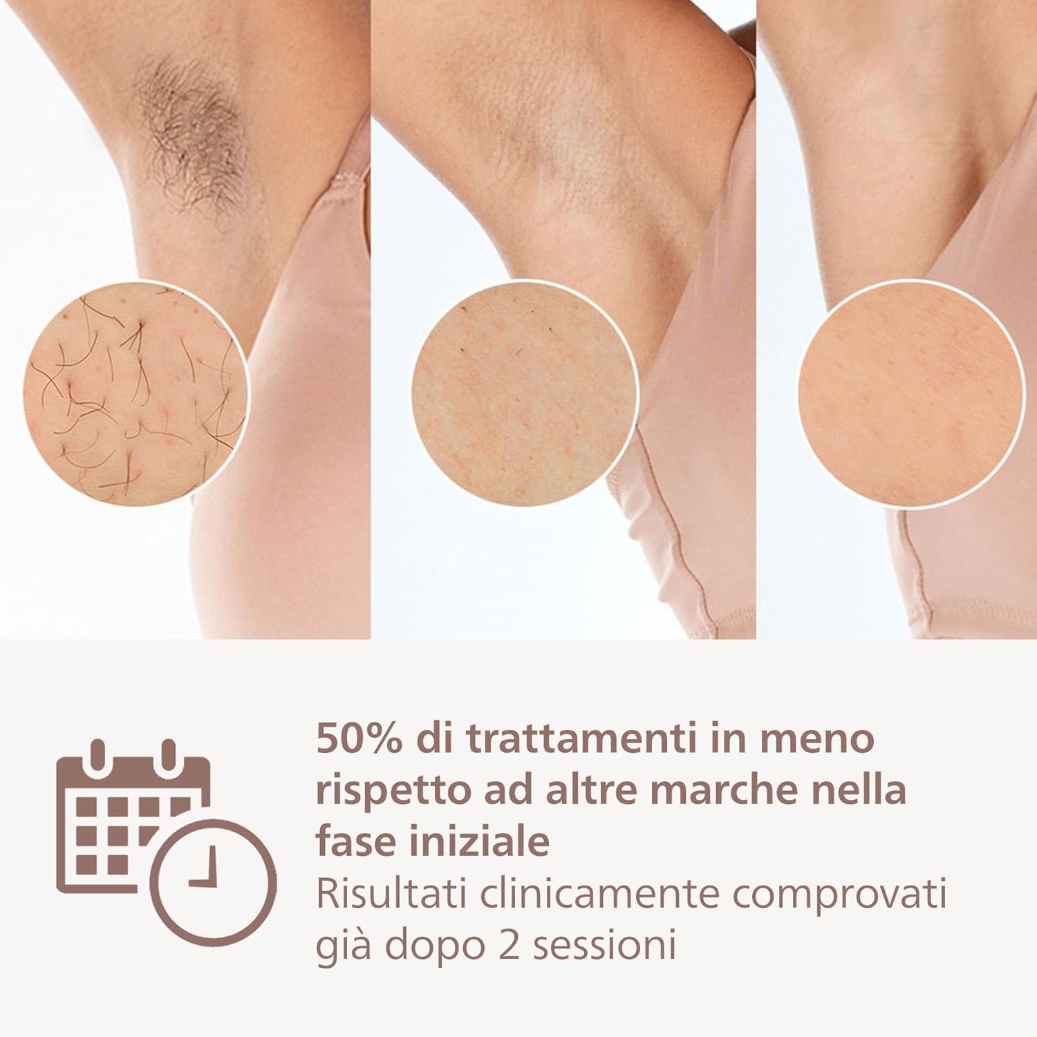 Thumbnail 3 de Philips Lumea 8000 Series BRI944/00: epilazione IPL domestica con SenseIQ e due accessori viso/corpo
