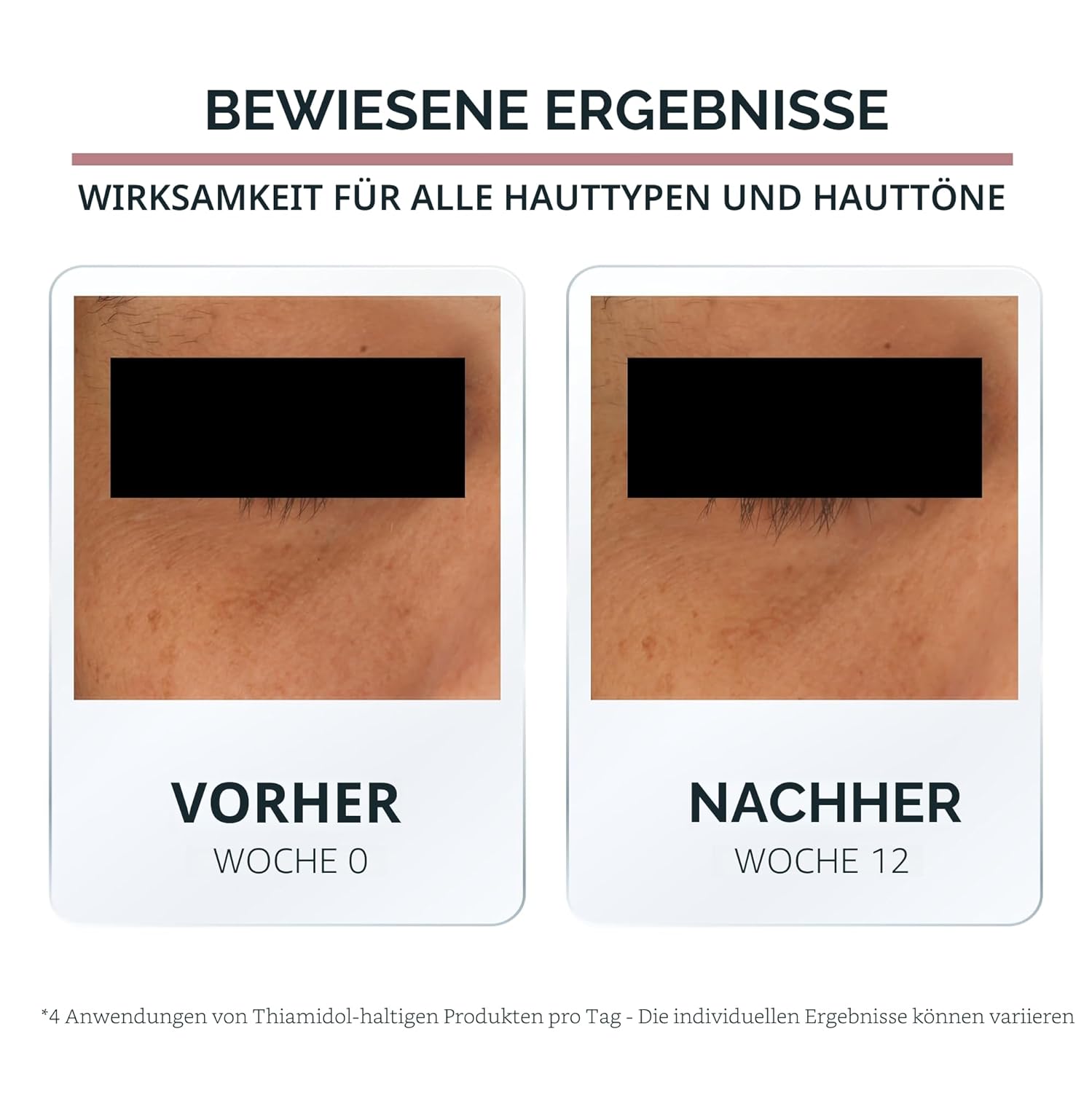 Detalle 2 de Eucerin Anti-Pigment Augenringe korrigierende Augenpflege – 15 ml