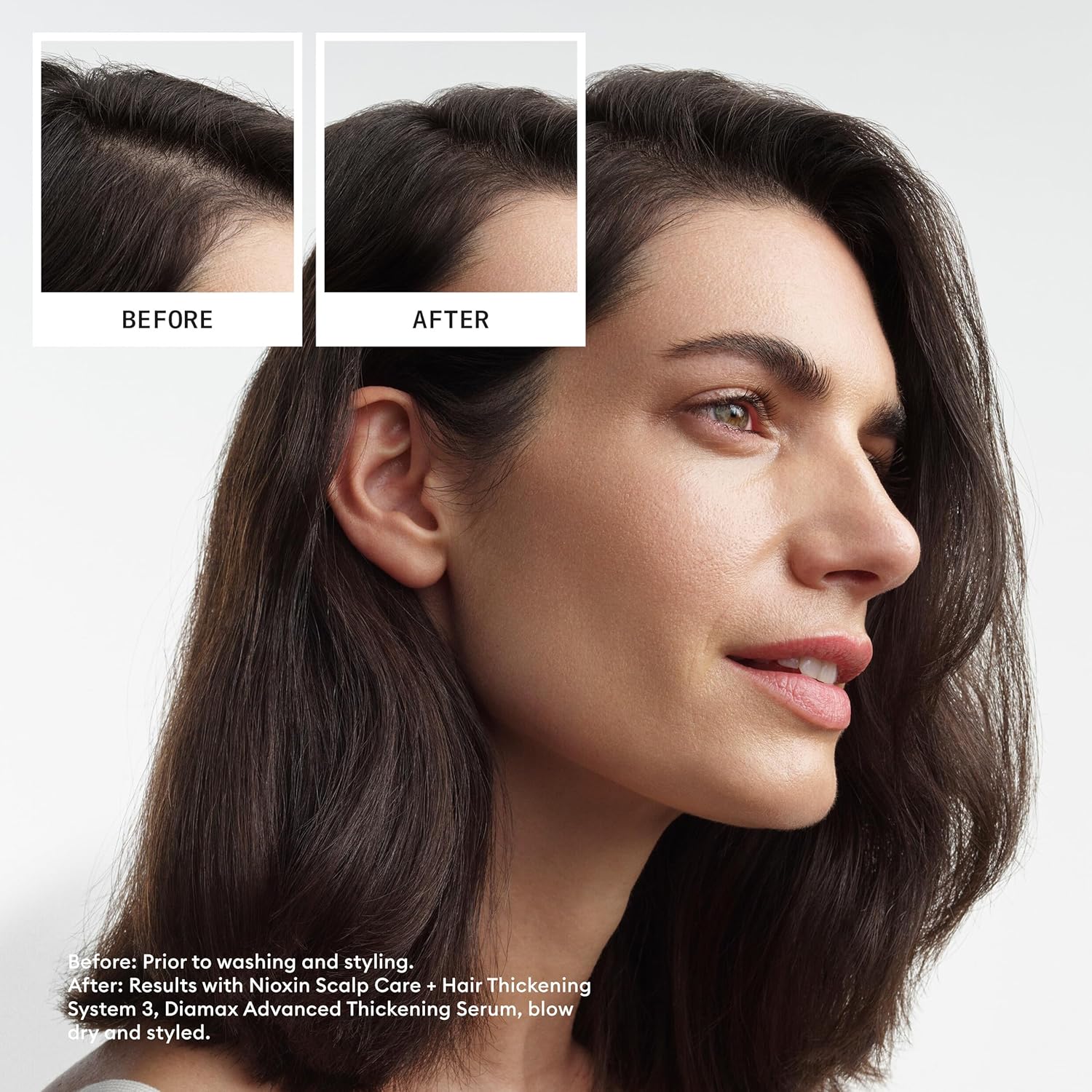 Thumbnail 5 de Nioxin System 3 Hair Thickening System for Damaged Hair (Light Thinning) with Biotin & Niacinamide – Shampoo, Conditioner, Serum