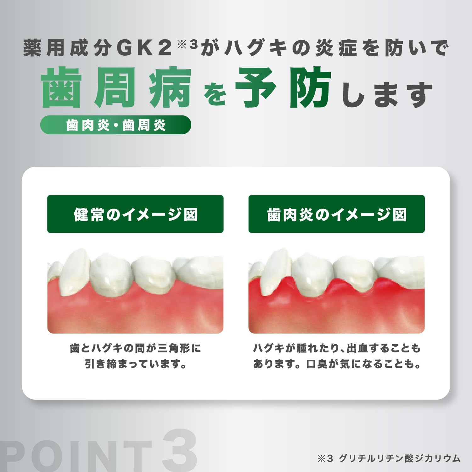 Detalle 2 de GUM(ガム)デンタルリンス ノンアルコールタイプ 液体ハミガキ 1300ml CPC配合