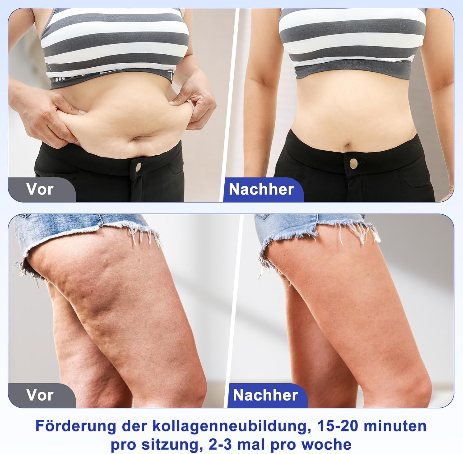 Thumbnail 3 de Ibtyzo 40k Cellulite Massagegerät 4-in-1 mit Ultraschall, RF & Vakuum – für Gesicht und Körper