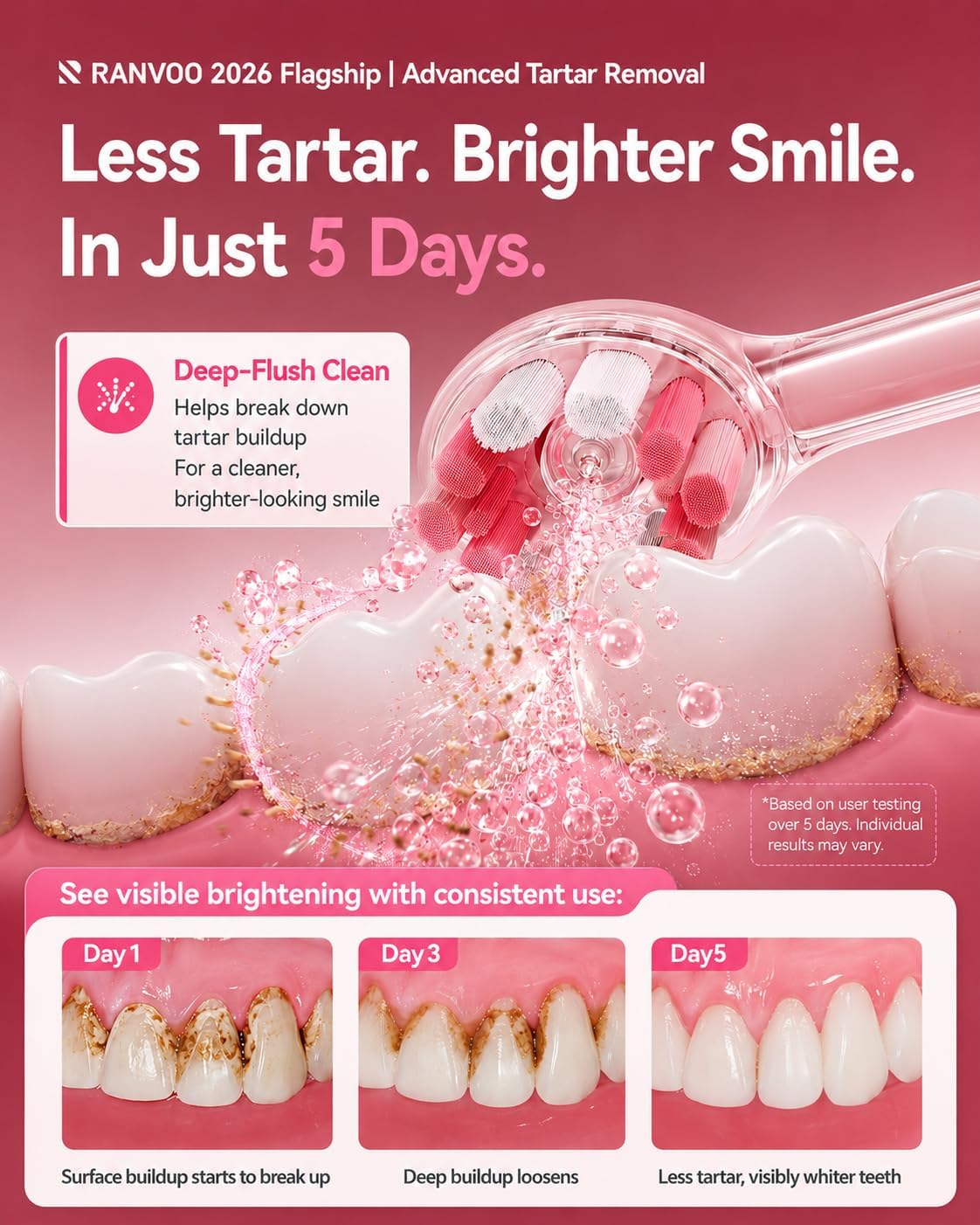 Detalle de RANVOO AirJet X5 Electric Toothbrush — 2026 Special Edition in Cyclamen Pink