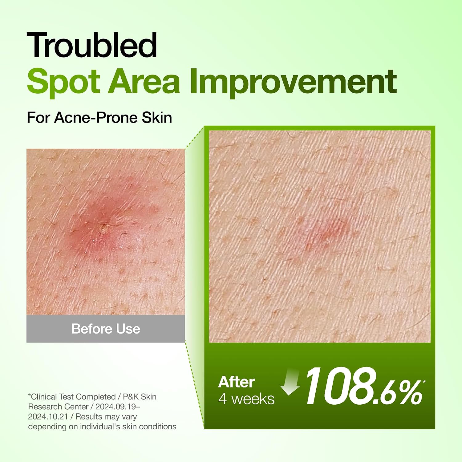 Thumbnail 4 de Anua Azelaic Acid 10 Serum for Redness 30ml