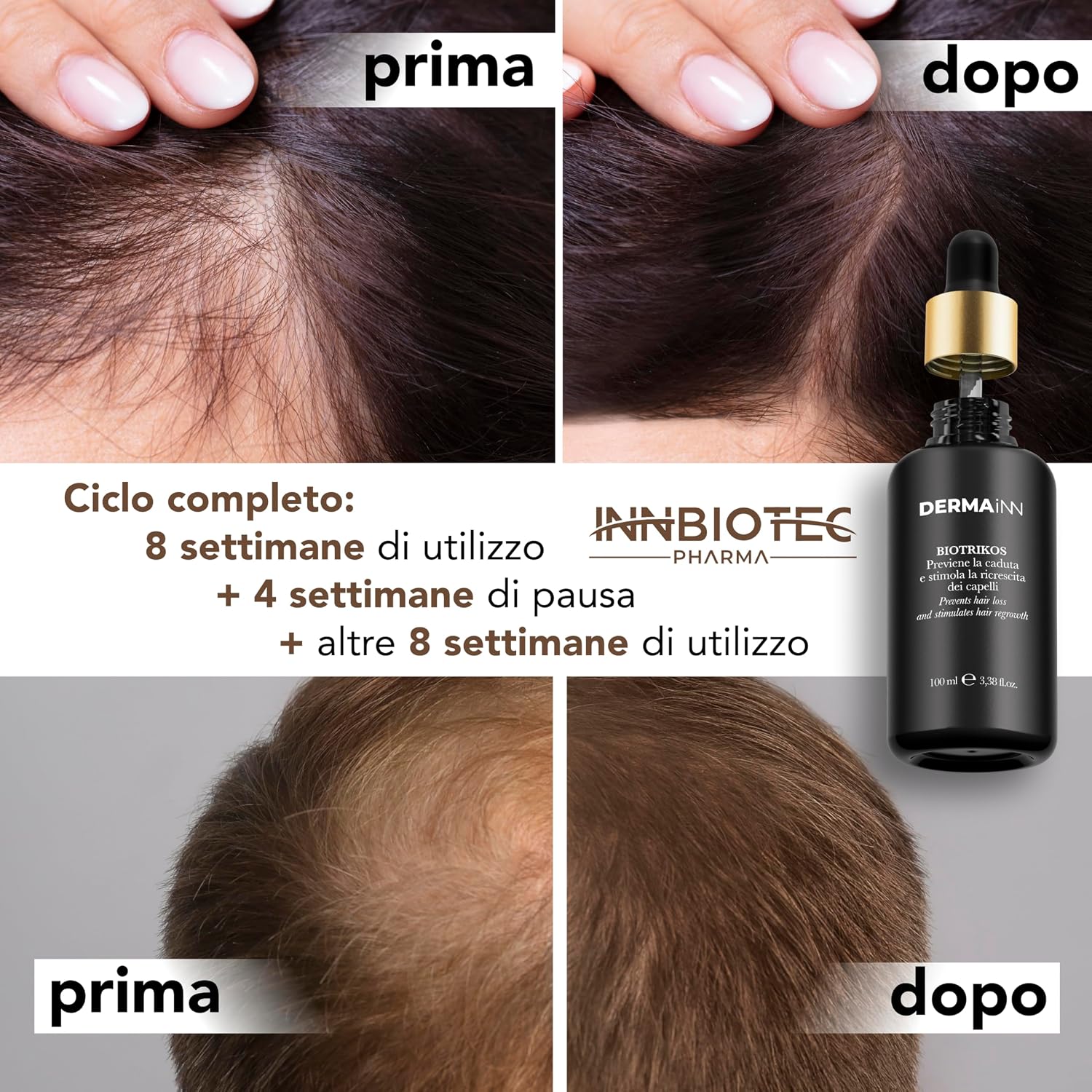 Thumbnail 2 de Biotrikos Siero Anticaduta Capelli e Barba – Lozione notte, fiale dosatrici, crescita e rinforzo