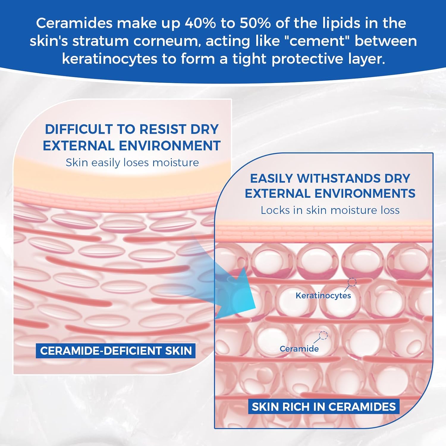 Thumbnail 5 de OUKEYA SA Glättende Feuchtigkeitscreme mit 5 Ceramiden, Salicylsäure & Hyaluronsäure (350 g) für trockene, raue Haut