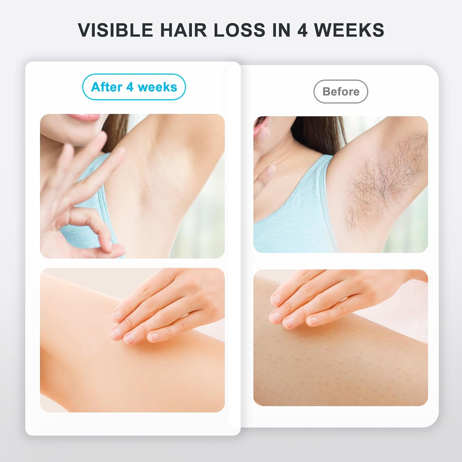 Detalle de IPL Hair Removal Device with 1200nm Range, 999,999 Flashes, and Dual Modes