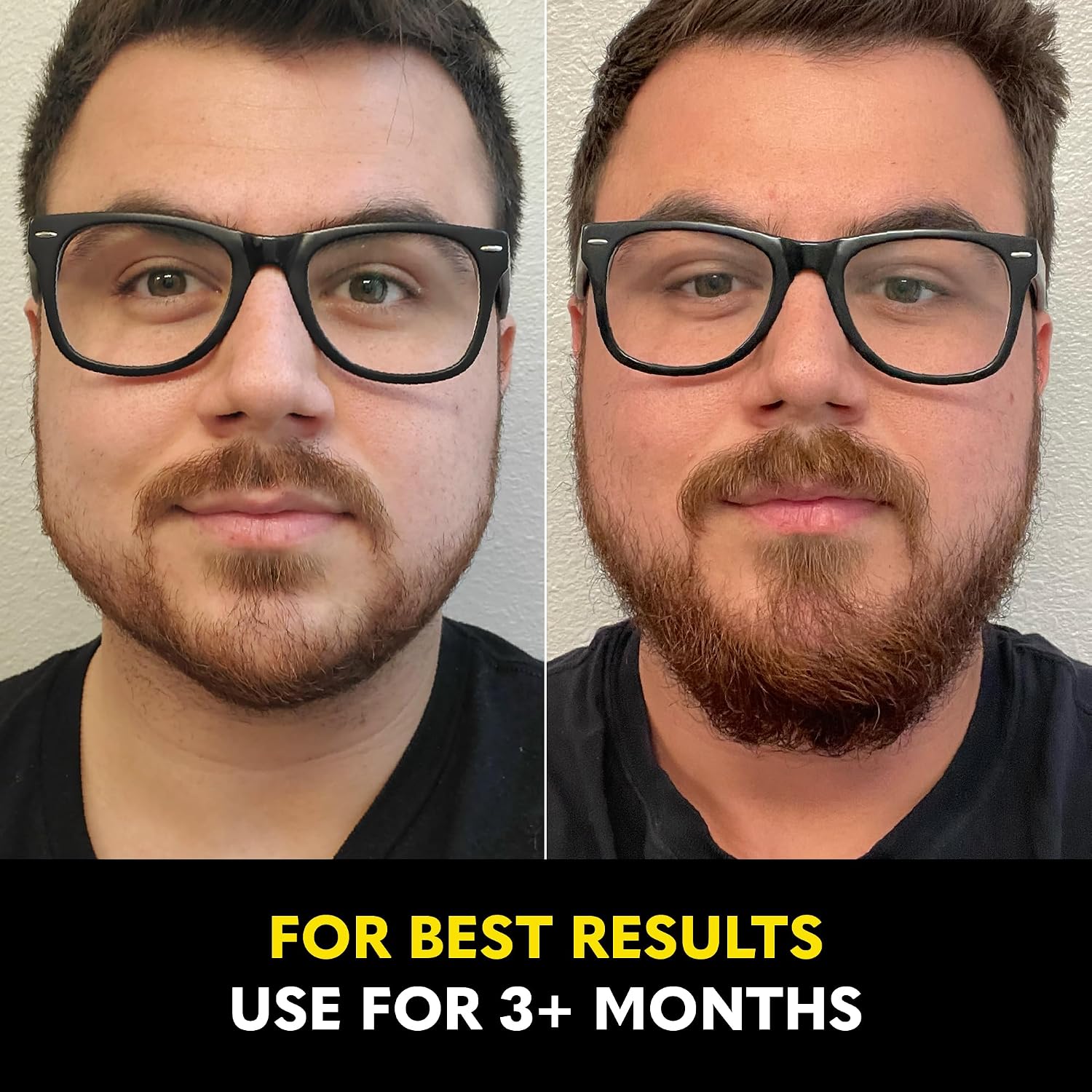 Thumbnail 5 de Beard Club Beard Growth Serum 🧔