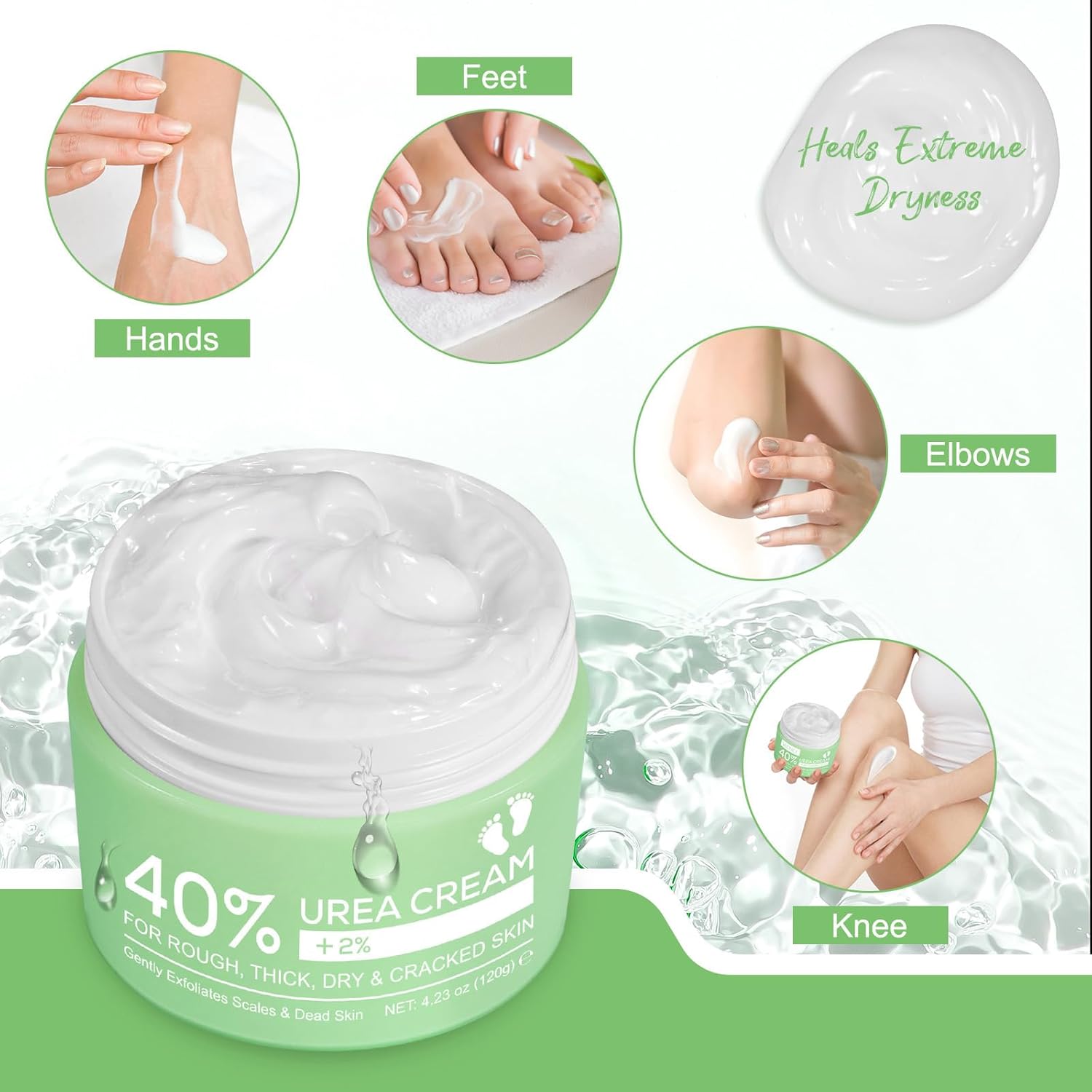 Detalle de Urea Creme 40 Prozent für trockene Haut – Hände, Füße, Ellbogen