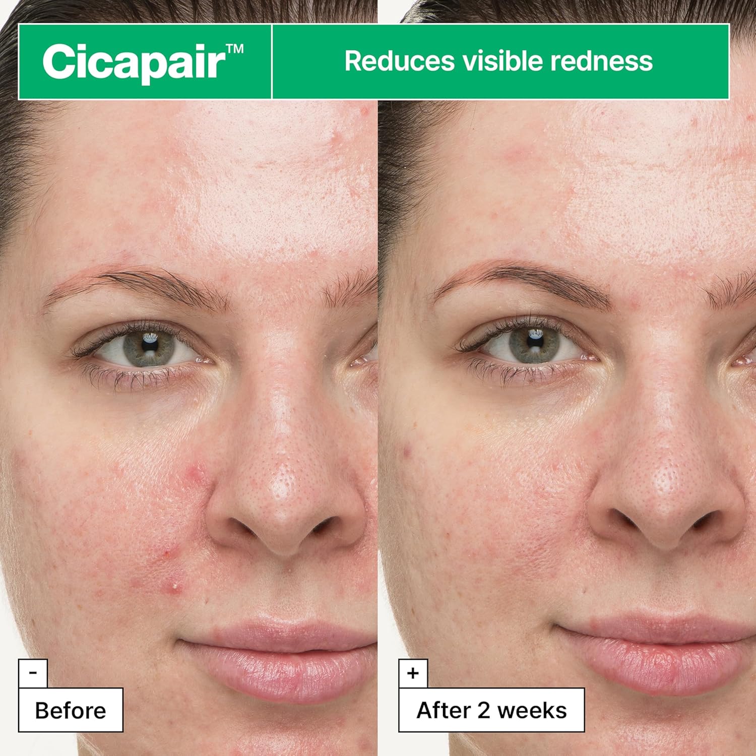 Thumbnail 2 de Dr.Jart+ Cicapair Trattamento Viso - Ripara la barriera cutanea con Centella Asiatica, 30 ml