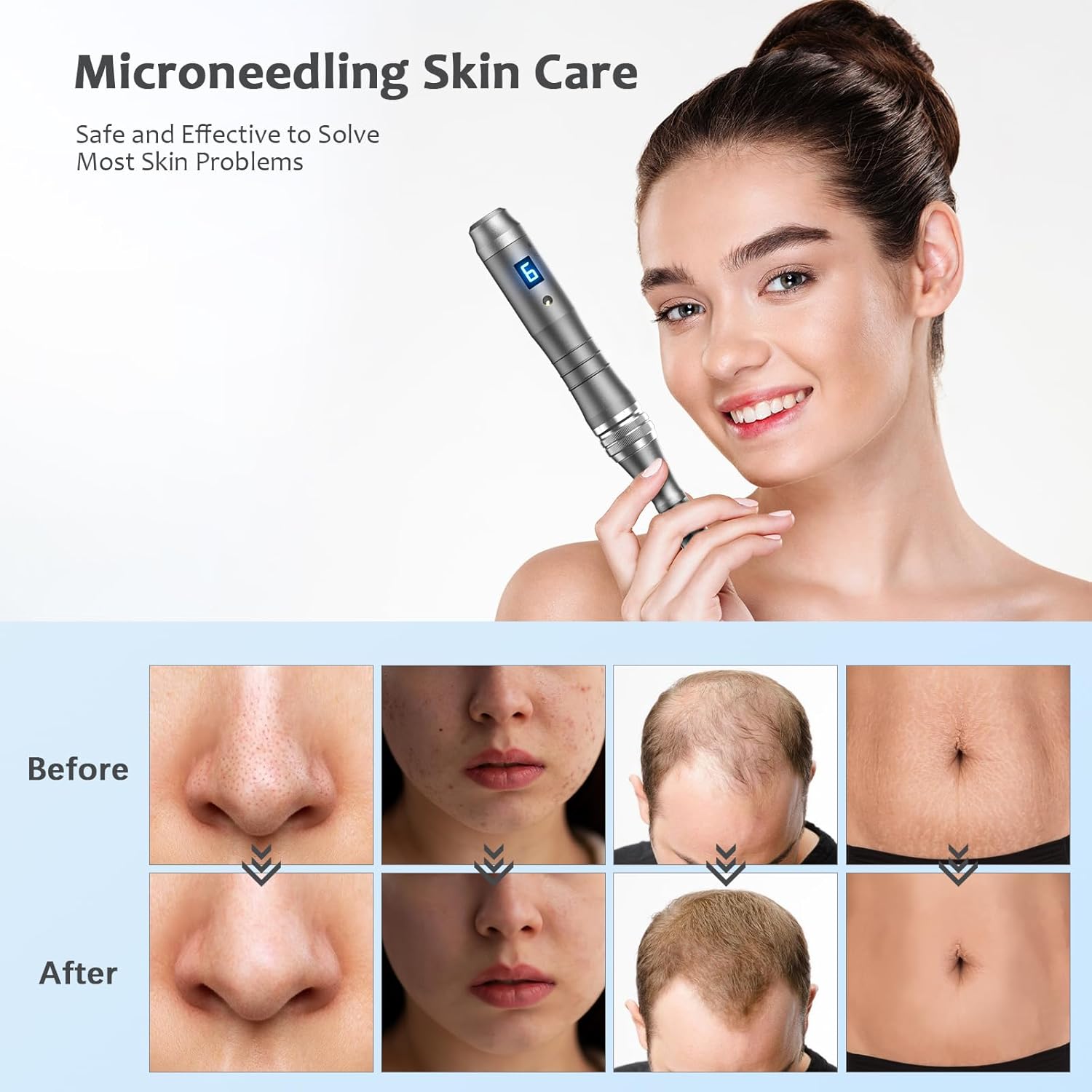 Thumbnail 5 de Dr. Pen Ultima M8 Microneedling Pen