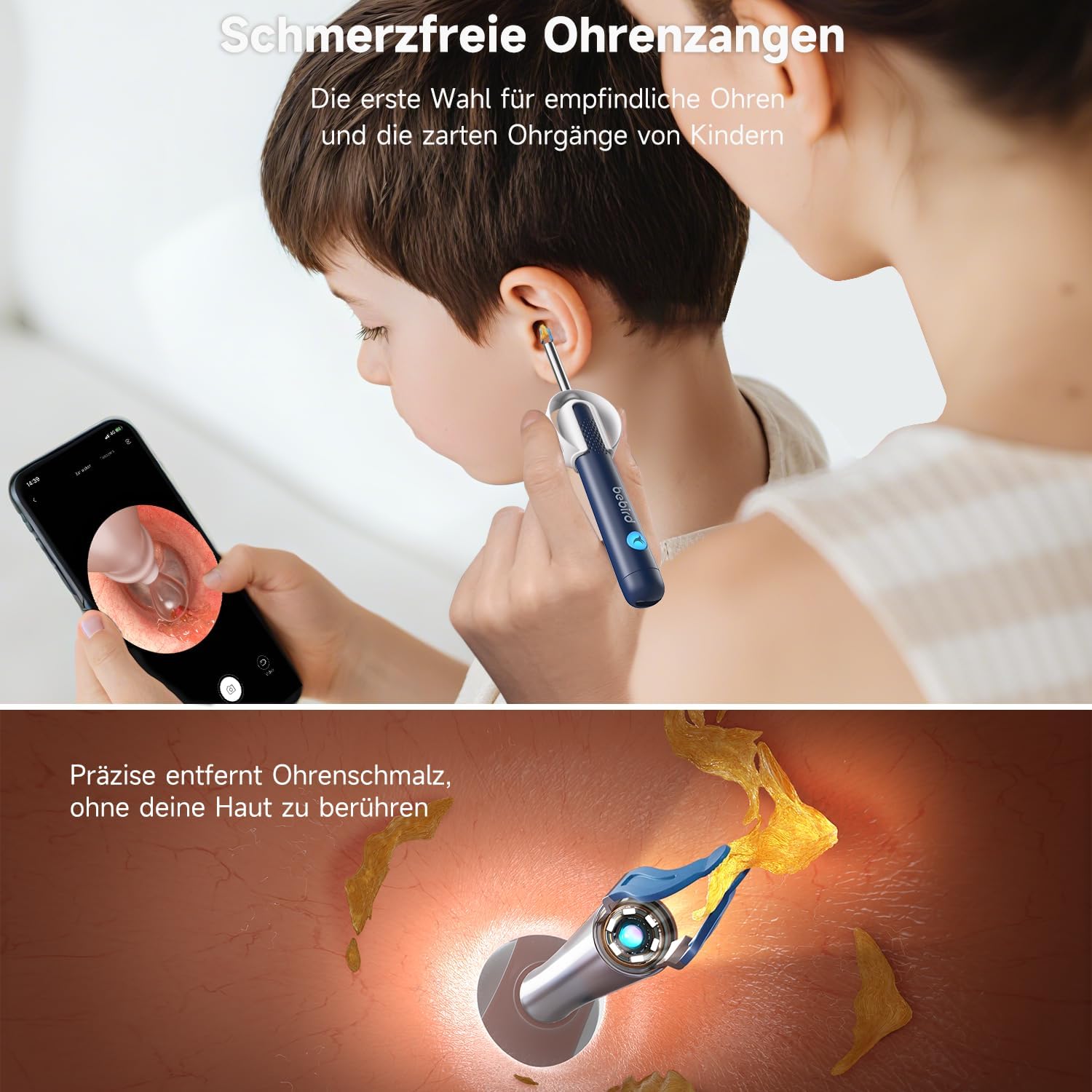 Detalle de BEBIRD R1 Ultra Ohrenschmalz Entferner mit Otoskop-Kamera – Komplett-Set für Zuhause
