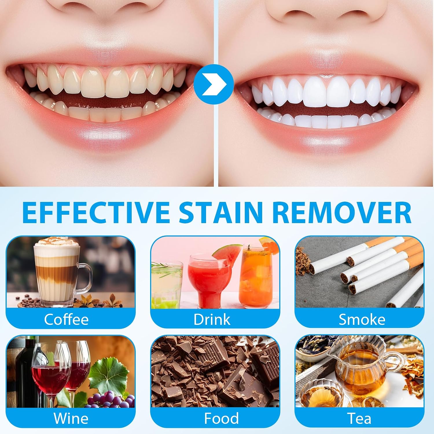 Detalle 2 de Kit sbiancante per denti con lampada domestica – 10 gel, 2 mascherine ausiliarie