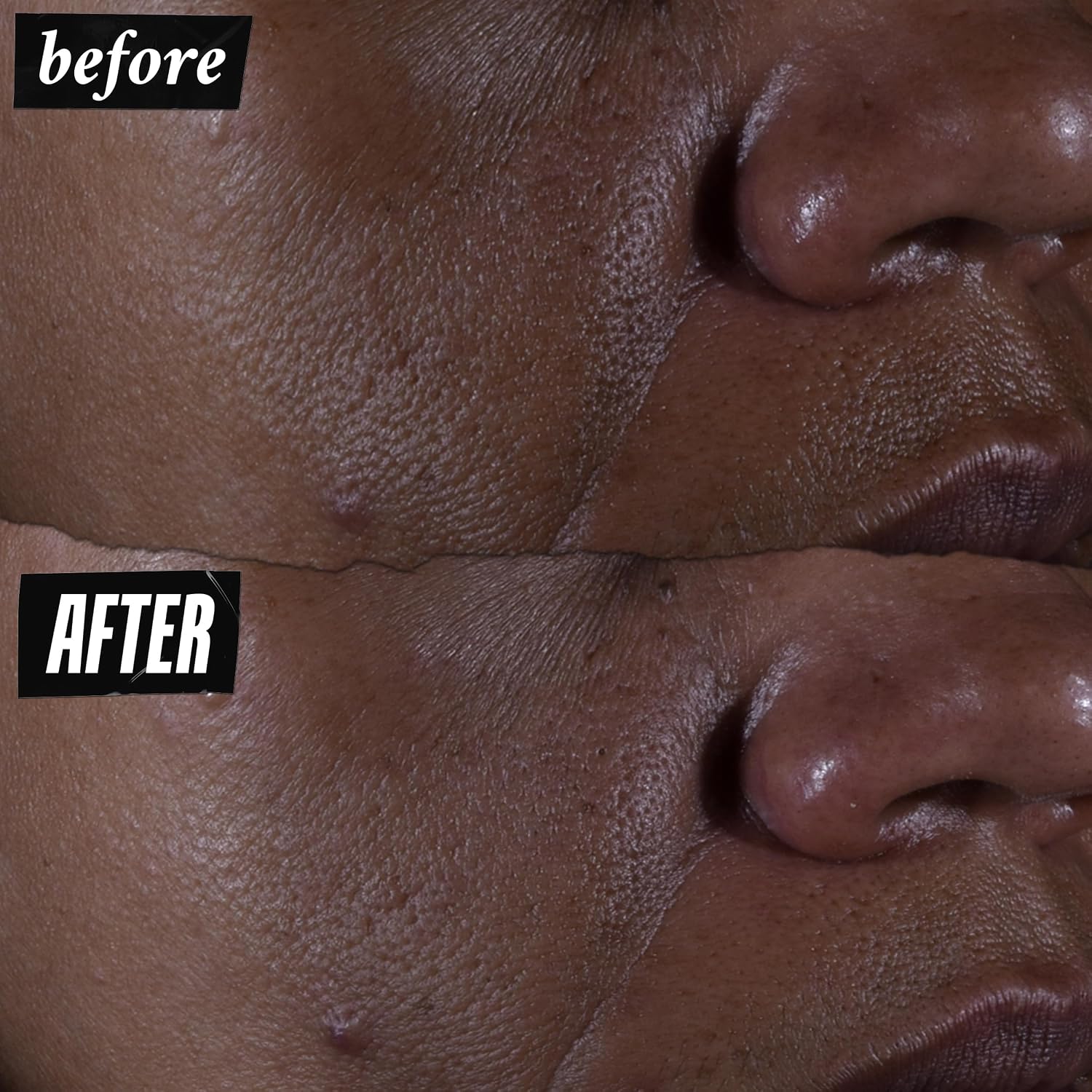 Thumbnail 2 de Kiehl's Ultra Pure High-Potency Glycolic Serum 30 ml