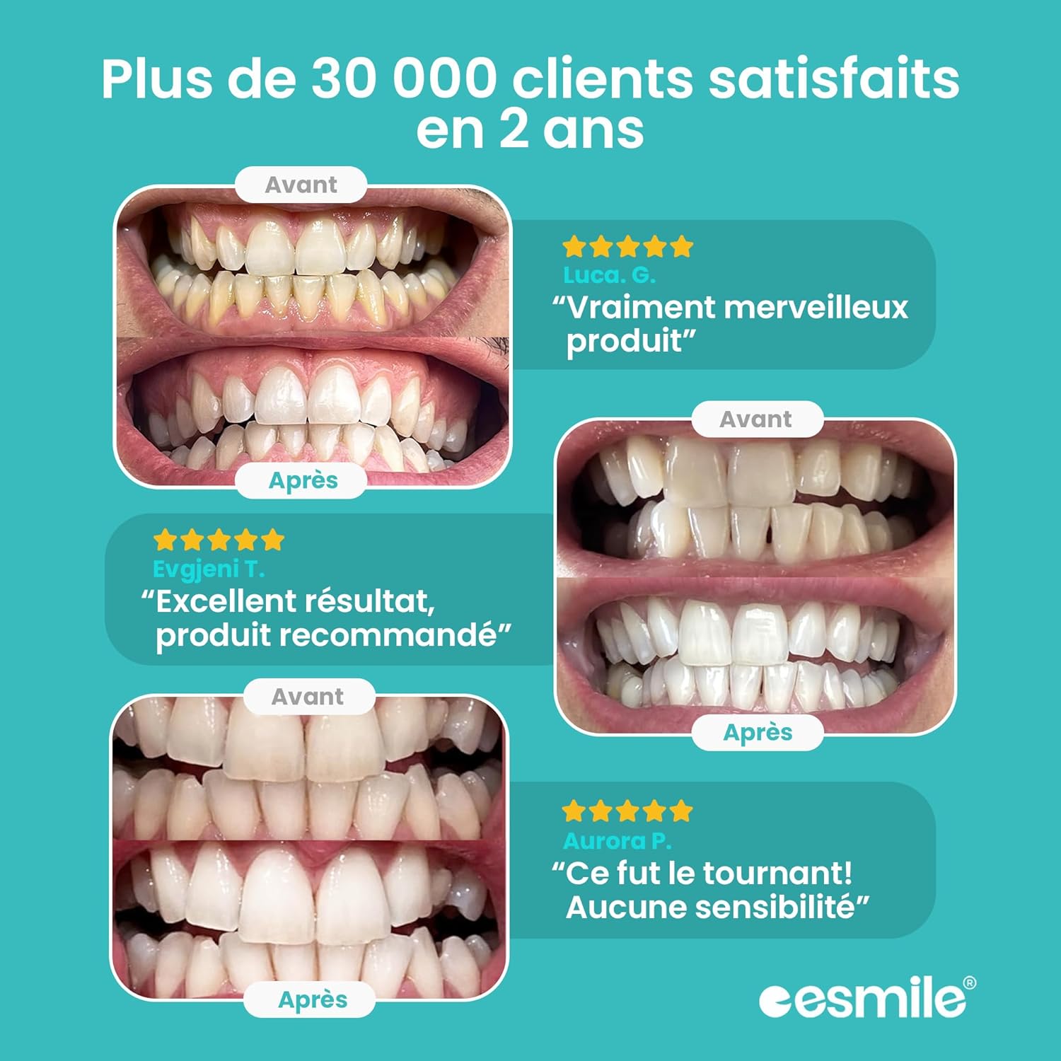 Thumbnail 2 de Esmile EASY SMILE blanchiment 16 min 🦷