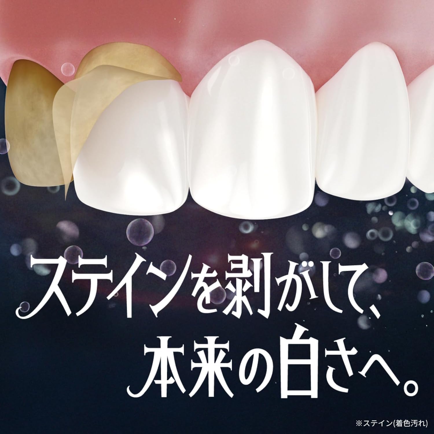 Thumbnail 1 de Ora2 プレミアムステインクリアペースト プレミアムミント 100g×2本・フッ素配合