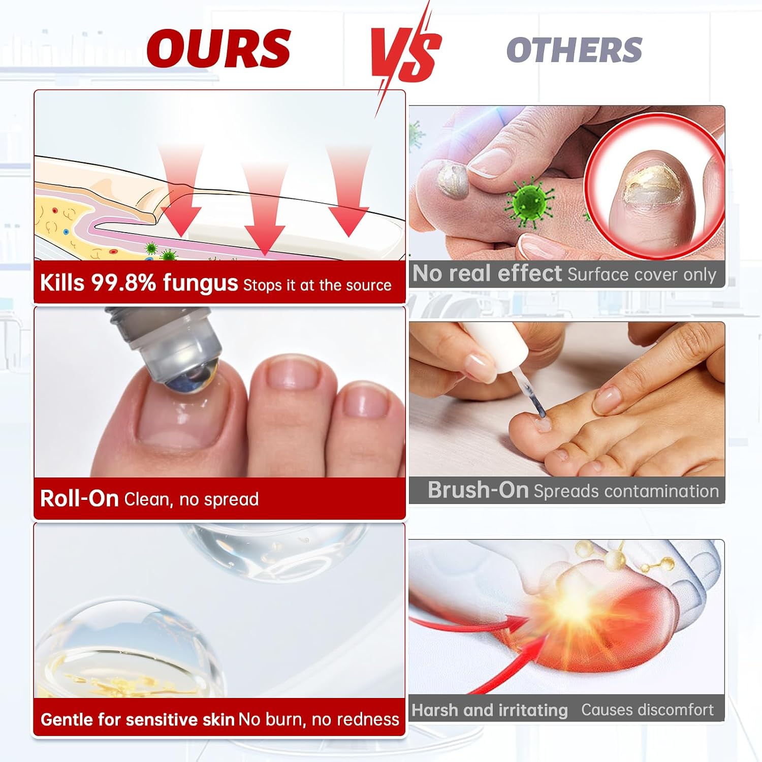 Thumbnail 4 de Toenail Fungus Treatment with 1% Tolnaftate