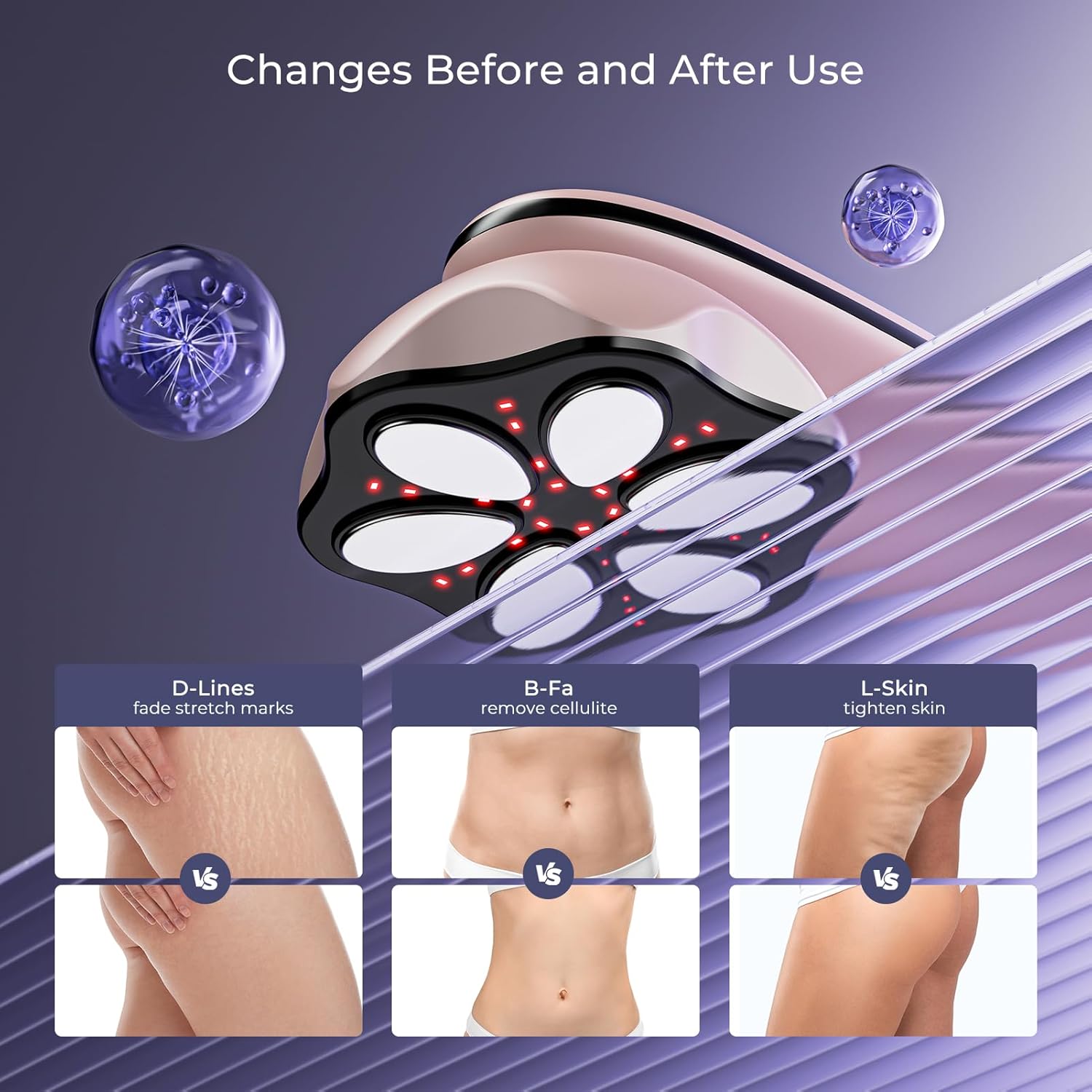 Thumbnail 3 de Oranmagic Cellulite Massager Tool: upgraded 6-electrode warm body sculpting device