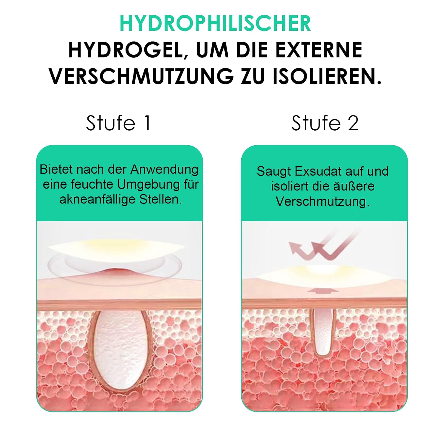 Detalle de Home Holic Pimple Patches 300 Stück