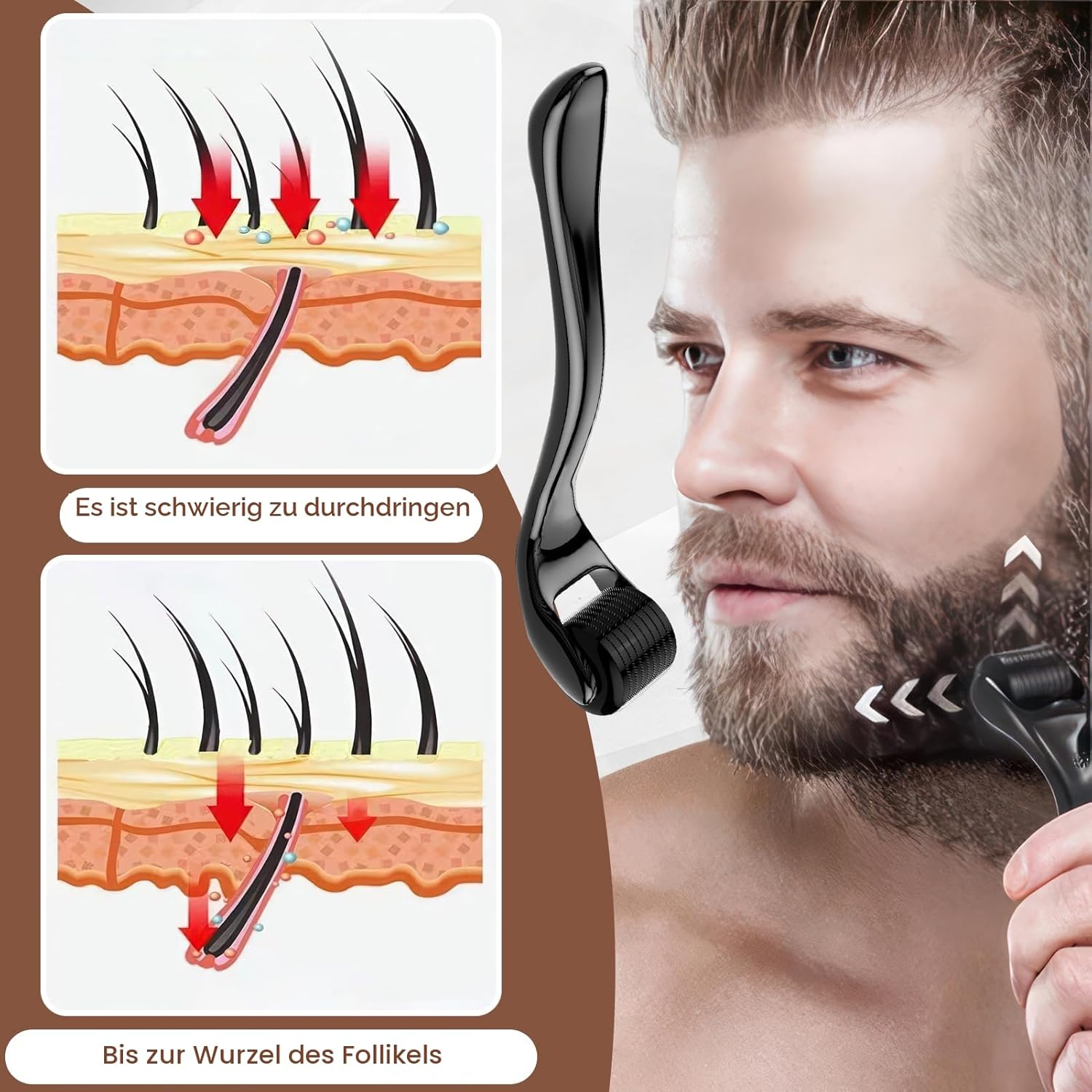 Detalle de Bartroller 0,5 mm Derma-roller mit 540 Titan-Nadeln für Bartwuchs