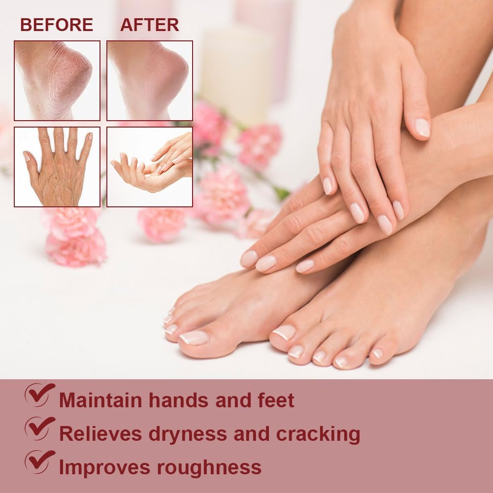 Detalle de ACWOO Foot Cream – urea foot moisturiser for cracked heels and dry, rough skin