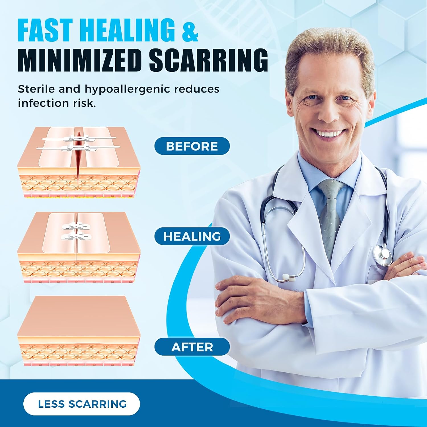 Thumbnail 4 de Senvok Butterfly Laceration Closure Kit with Adjustable No-Sew Closures