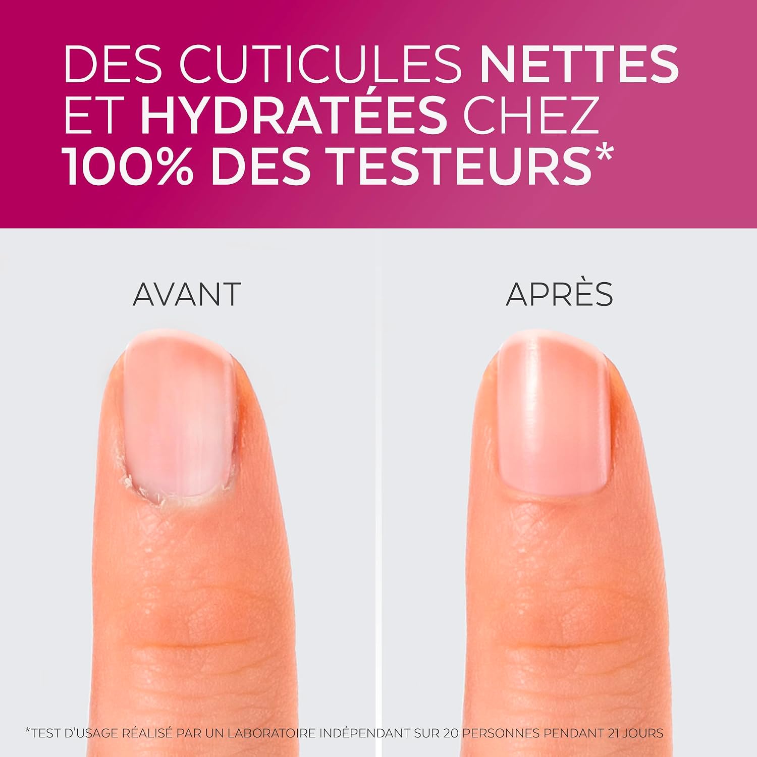 Detalle de Poderm Emollient Cuticule 2en1 – Soin cuticules exfoliant et hydratant, Swiss quality