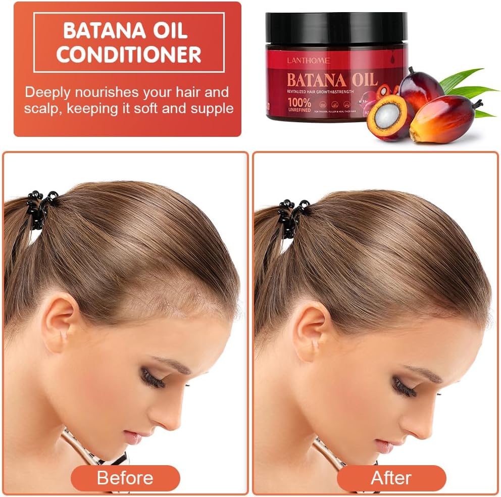 Detalle de ACWOO U5-BTNY240709-FBA batana-olie voor haar, 120 ml