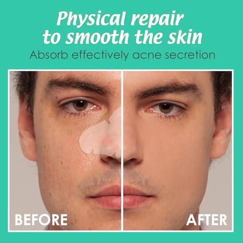 Detalle 2 de Pimple Patches Hydrokolloid Unsichtbare Patch für Akne 20 Stück
