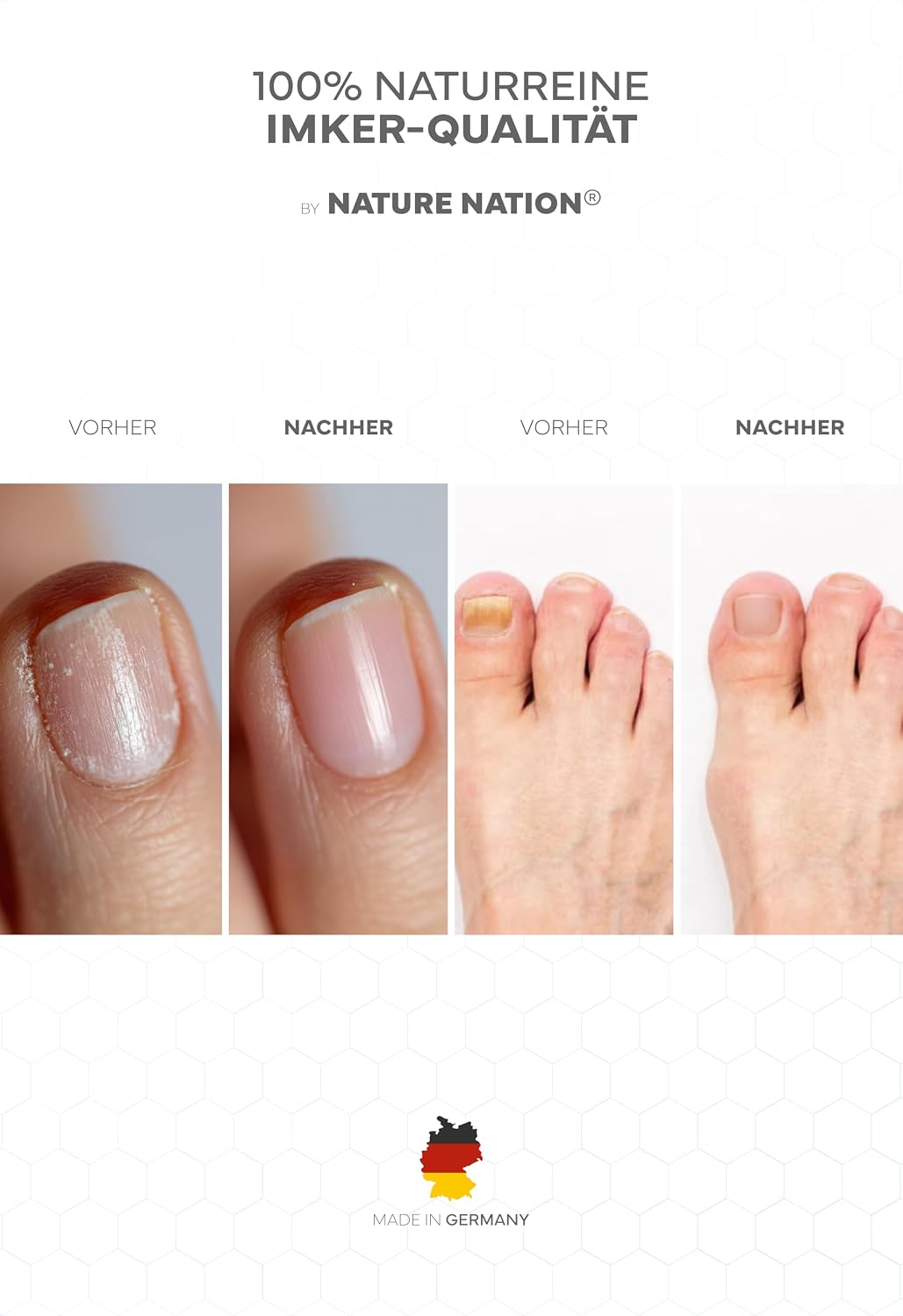 Thumbnail 1 de BIO Propolis Nagelserum: Akute Intensivpflege bei Nagelveränderungen