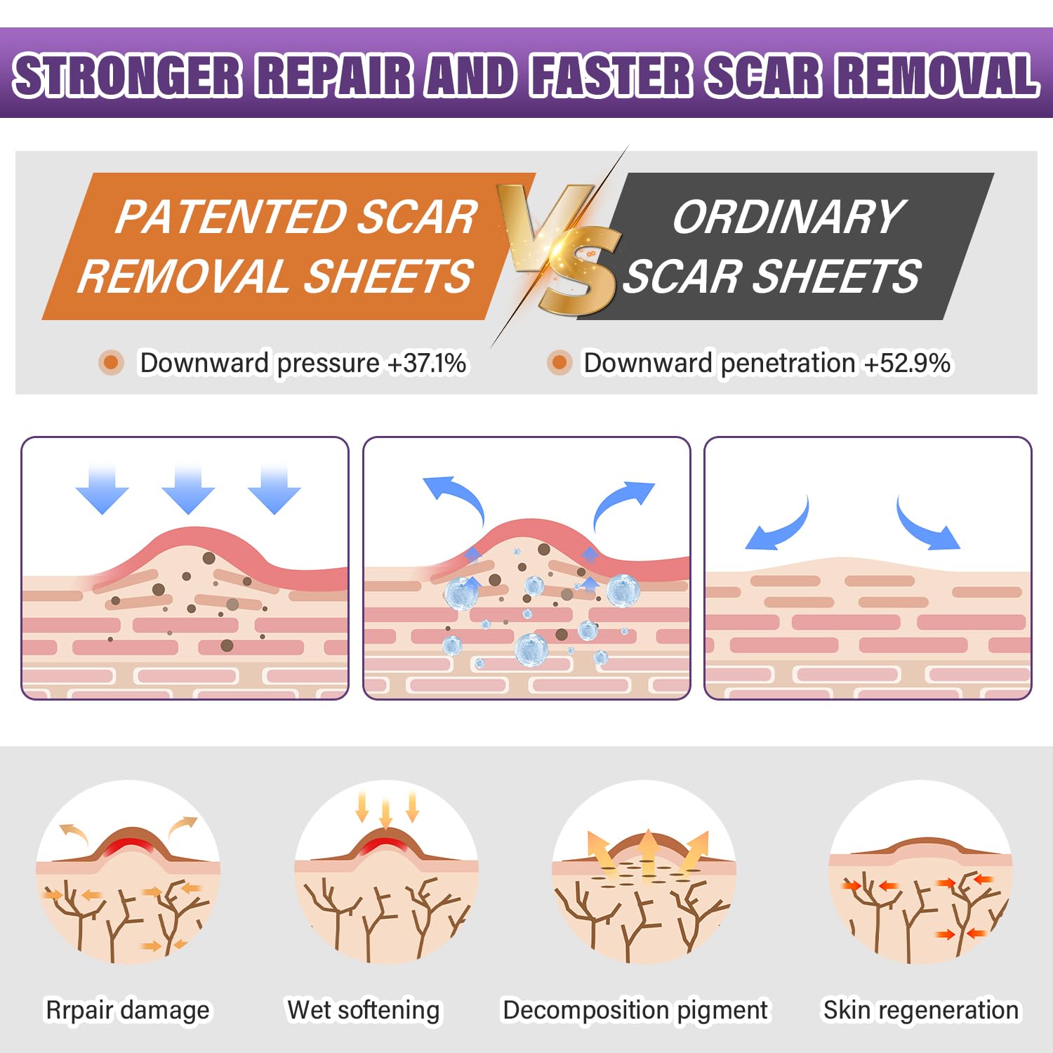 Thumbnail 2 de Silicone Scar Sheets 1.5M Roll