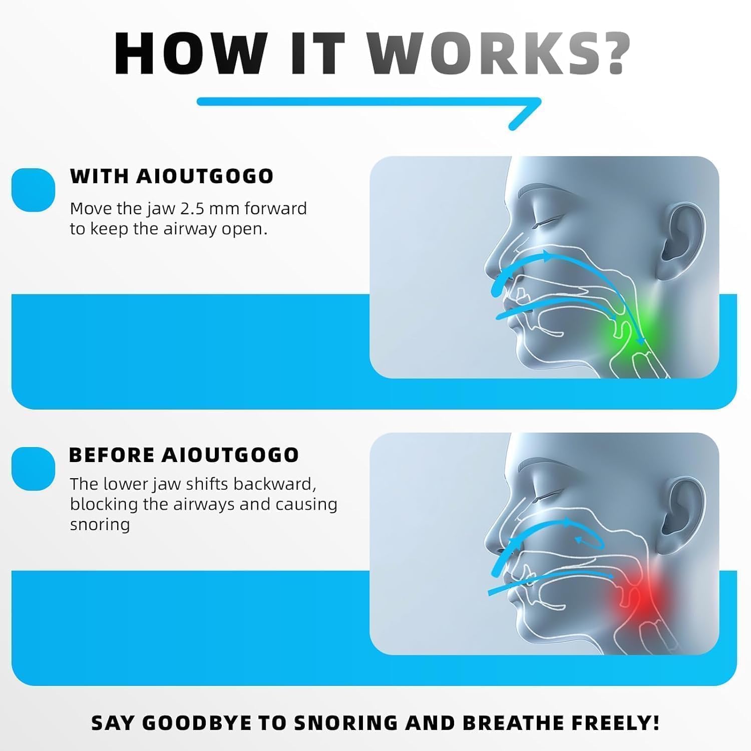 Detalle 2 de Anti Snoring Mouthpiece Devices with 180 Open Front Design (jaw forward by 2.5mm)