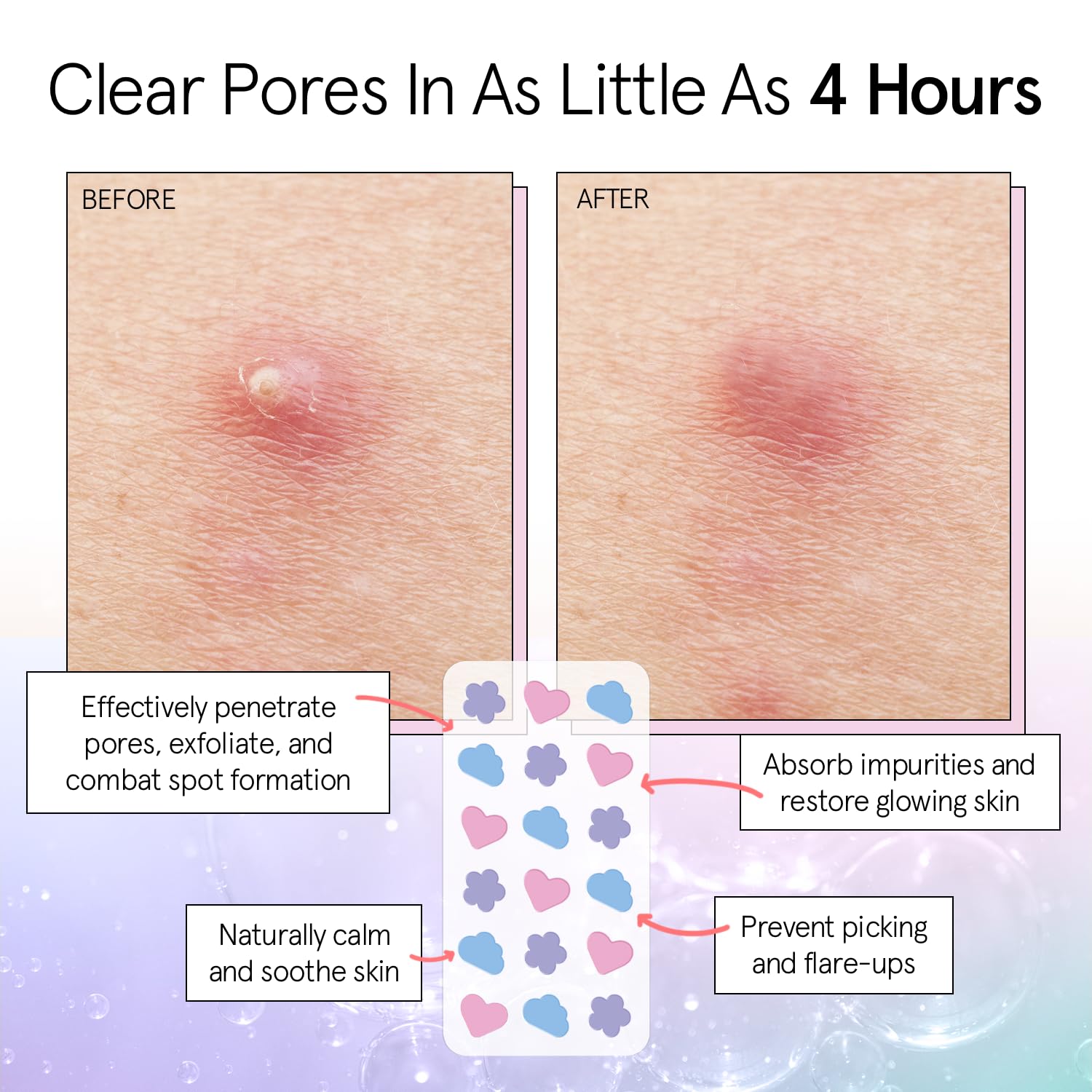 Thumbnail 2 de grace & stella Pimple Patches 36 🩹