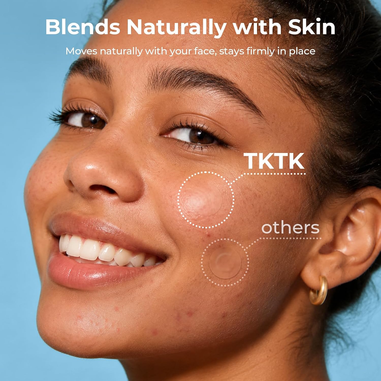 Detalle 2 de TKTK Hydrocolloid Pimple Patches 180-count