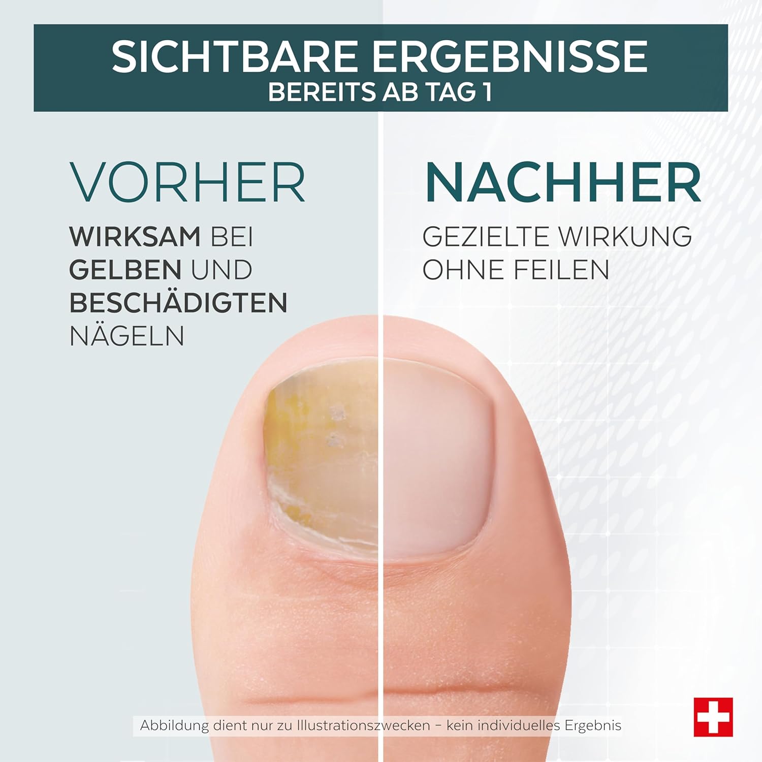 Thumbnail 2 de PODERM Tea Tree Nagel-Repair-Serum 6 ml (4-in-1 Pflege) – Swiss Made