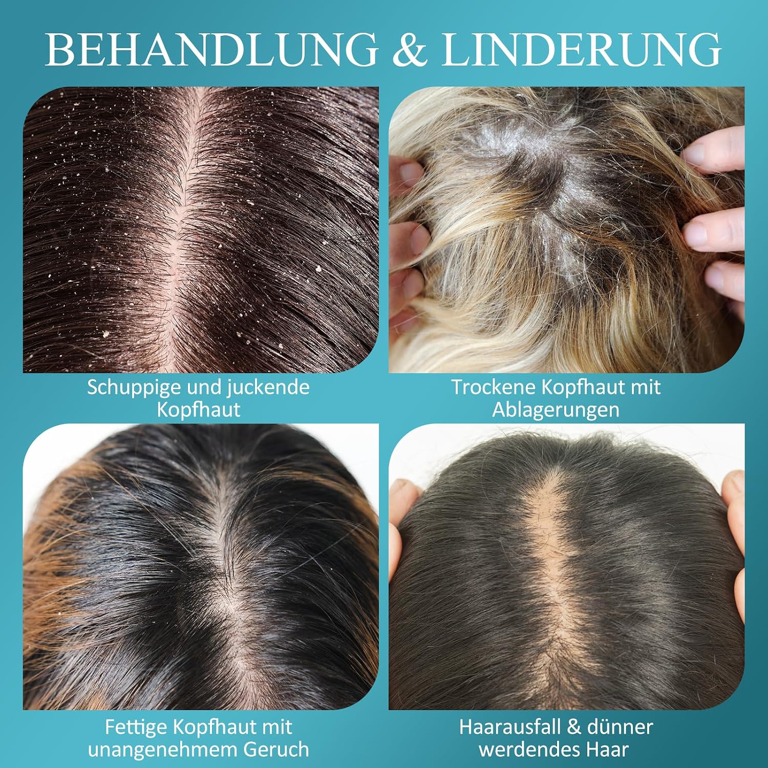 Detalle de SHVYOG Kopfhautpeeling mit 250 g