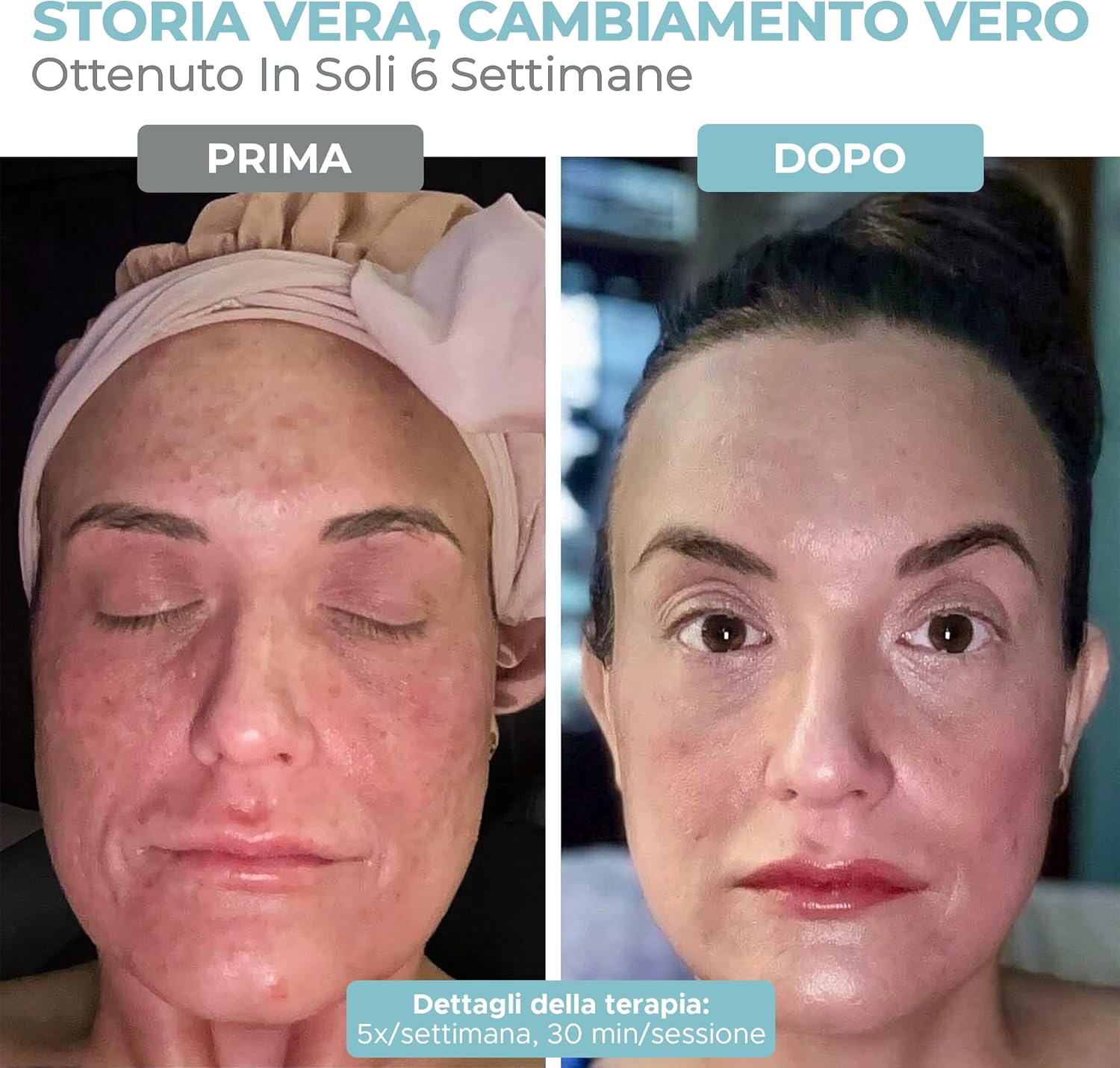 Detalle 2 de Nourished Bodynskin Maschera LED Viso 7 Colori 114 LED
